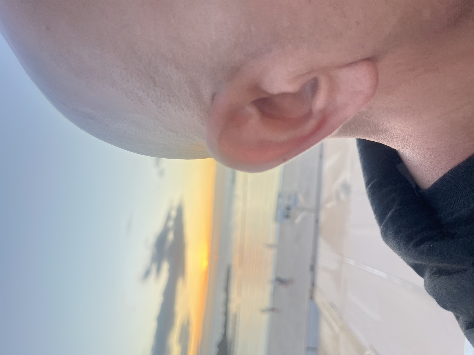 Close-up, angled view of a person's head, including a partially visible ear and the side of a bald head. The backdrop features a beach scene with an orange and yellow sunset. Blurred figures of people can be discerned on the beach. A white railing and tiled flooring are also visible in the foreground. Based on the sunset hues and beach setting, the location is likely within the municipality of Mogán, Spain, known for its coastal areas.