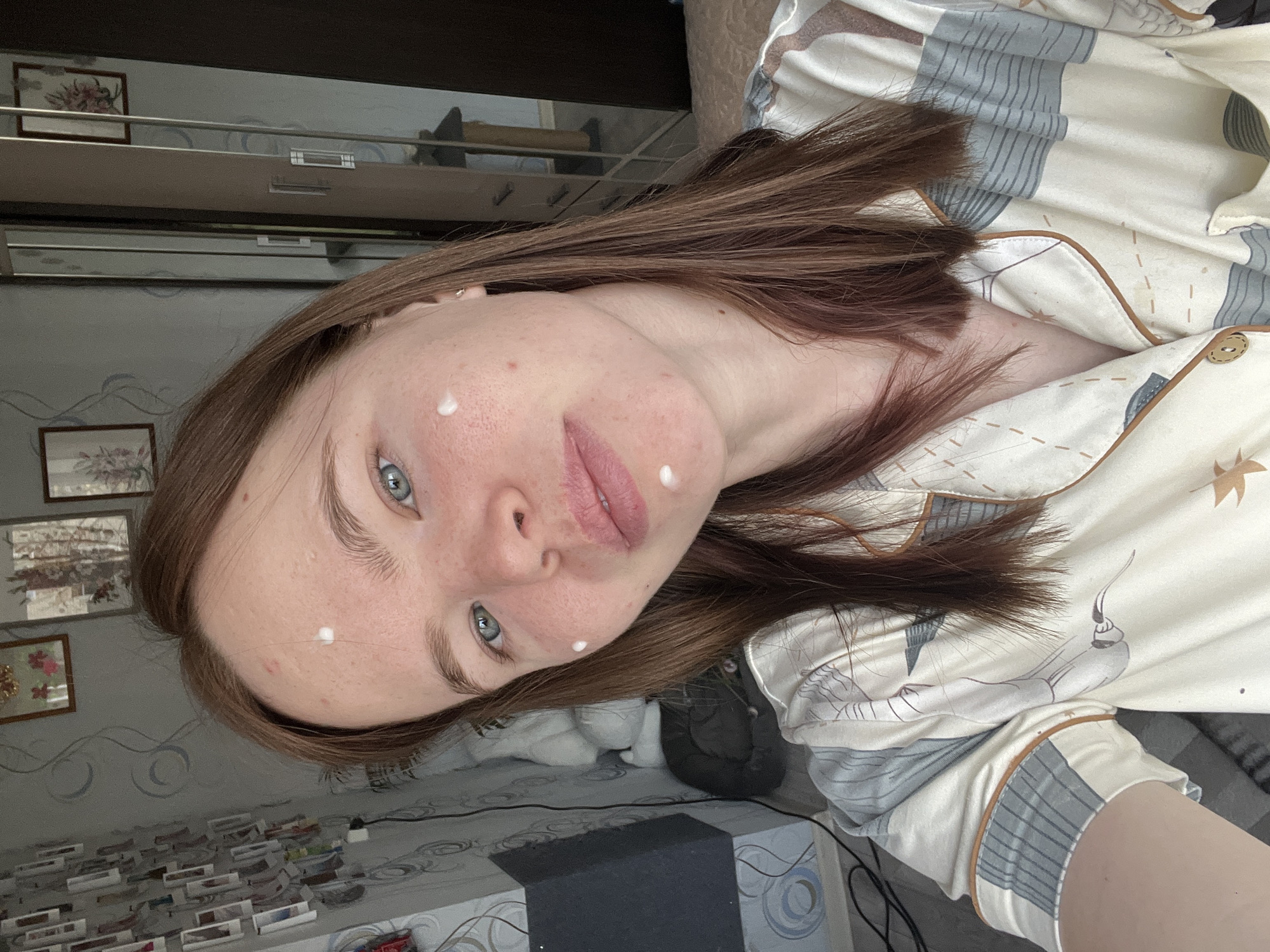 A woman with light skin, freckles, and brown hair is shown in a close-up, angled selfie. She has blue eyes and is wearing light pink lipstick. There are small white dots of what appears to be cream or ointment on her forehead, cheek, and chin. She is wearing pajamas patterned with light blue and gray designs.
The background shows a wall with framed pictures and a dresser. There are also some items on a shelf. A patterned bedspread is visible, along with a black rectangular object and a power cord on the floor.
The image appears to have been taken indoors in a residential setting, possibly in Chaikovsky, Russia.