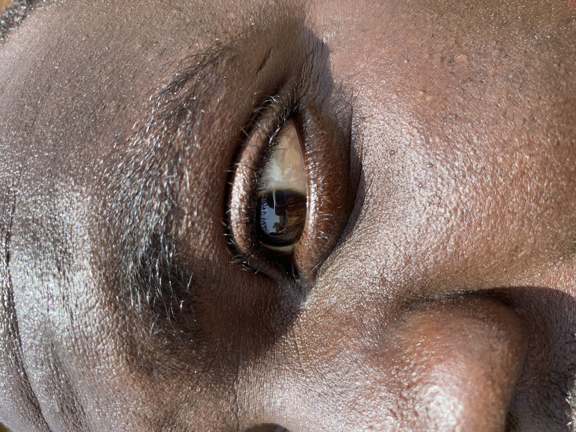 This is a close-up, eye-level, medium shot of a person's right eye and surrounding facial skin. The subject appears to be of African descent, with dark brown skin that is glistening, suggesting perspiration or oil. The eye is open, and the iris is a rich brown color. The sclera, or the white part of the eye, has visible reddish veins, indicating potential irritation or tiredness. The eyelashes are dark and numerous. The skin texture is detailed, showing pores and fine lines. The lighting is harsh, creating strong highlights and shadows, particularly on the forehead and cheek area, suggesting outdoor conditions. The background is out of focus, but the reflection in the eye shows what appears to be an outdoor environment with a building and possibly trees. The location provided is Bukuru, Nigeria.