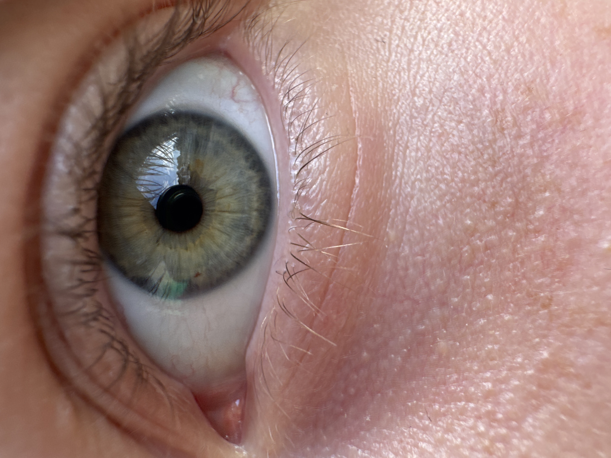 A macro photograph captures a human left eye in extreme close-up. The central iris is predominantly green with radial striations and hints of hazel, featuring a small, reddish-brown macule at approximately the one o'clock position. The pupil is dark, round, and centrally dilated. Strong reflections within the pupil and iris depict a clear blue sky with white cumulus clouds, and an indistinct, distant green and brown landscape or foliage, indicating an outdoor or window-lit setting.
The sclera (white of the eye) shows fine, red capillary vessels, particularly noticeable towards the outer corner. Dark, curved eyelashes are visible on both the upper and lower eyelids. The skin of the lower eyelid and the area immediately beneath it is highly detailed, displaying fair, pinkish tones, prominent pores, fine lines and creases, and scattered fine, light-colored vellus hairs. Several minute white specks are present on the skin surface below the eye. The inner canthus and the lacrimal caruncle are visible in the lower left portion of the image. The exact location is not discernible from the image and remains Unknown, Unknown.
