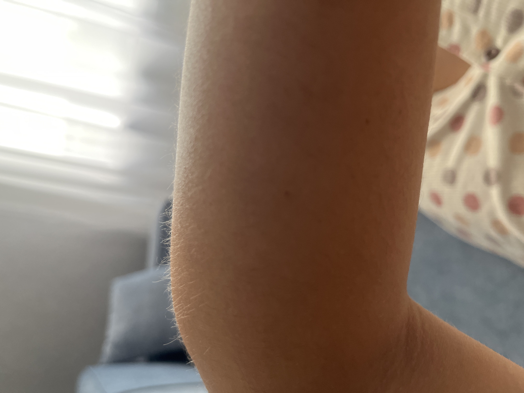 The image shows a close-up of a person's arm, likely the upper arm and elbow area. The skin is lightly tanned and shows fine, light-colored hair, especially noticeable along the edge of the arm where it is illuminated by light. The background is softly blurred, with hints of a bright, possibly sunlit window on the left, featuring horizontal blinds. To the right, a patterned fabric with large, softly colored polka dots (pink, beige, and grey) is visible, suggesting clothing or upholstery. Further in the background, there are muted colors of furniture, possibly a sofa or chair, with a light blue fabric. The overall lighting suggests it is daytime, with bright natural light coming from the left. The scene appears to be indoors, in a casual setting like a living room. There are no discernible emotions or specific activities taking place, as the focus is solely on the arm. No text is visible in the image.