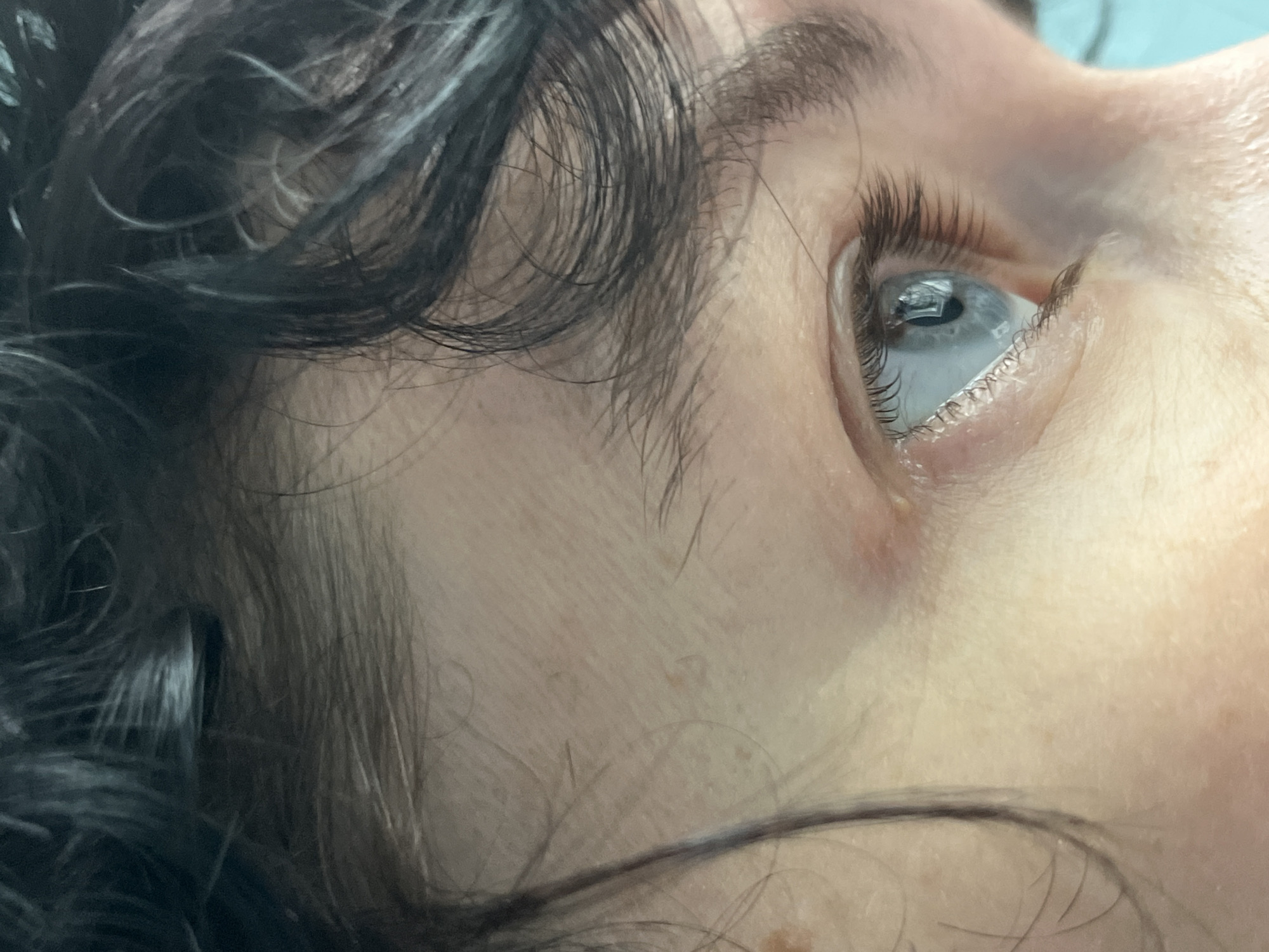 A close-up, profile view of a person's left eye and forehead, with dark, curly hair framing the face. The iris is a pale blue, reflecting a dark object. The skin shows some texture and a few light brown spots. The scene is indoors, with no discernible environmental details to indicate a specific location within ღრმაღელის თემი, Georgia.
