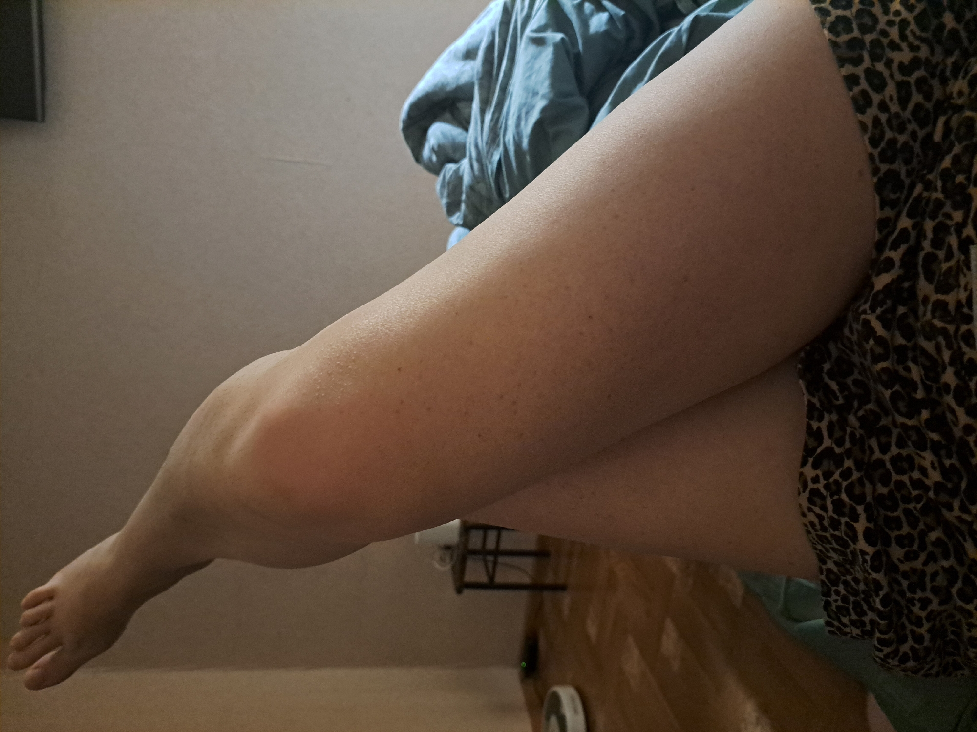 The image is a close-up, low-angle shot of a person's legs, positioned in a bedroom. The person is lying down, with their left leg bent and extended upwards, while the right leg is crossed over it. The person is wearing leopard-print shorts. The background reveals a light-colored wall, a blue comforter, a wooden floor, and a small stool with a white object on it. A white robotic vacuum cleaner is visible on the floor in the distance. The lighting is dim, suggesting it might be evening or a room with limited natural light. The image does not provide any information about the location being in Yessentuki, Russia.