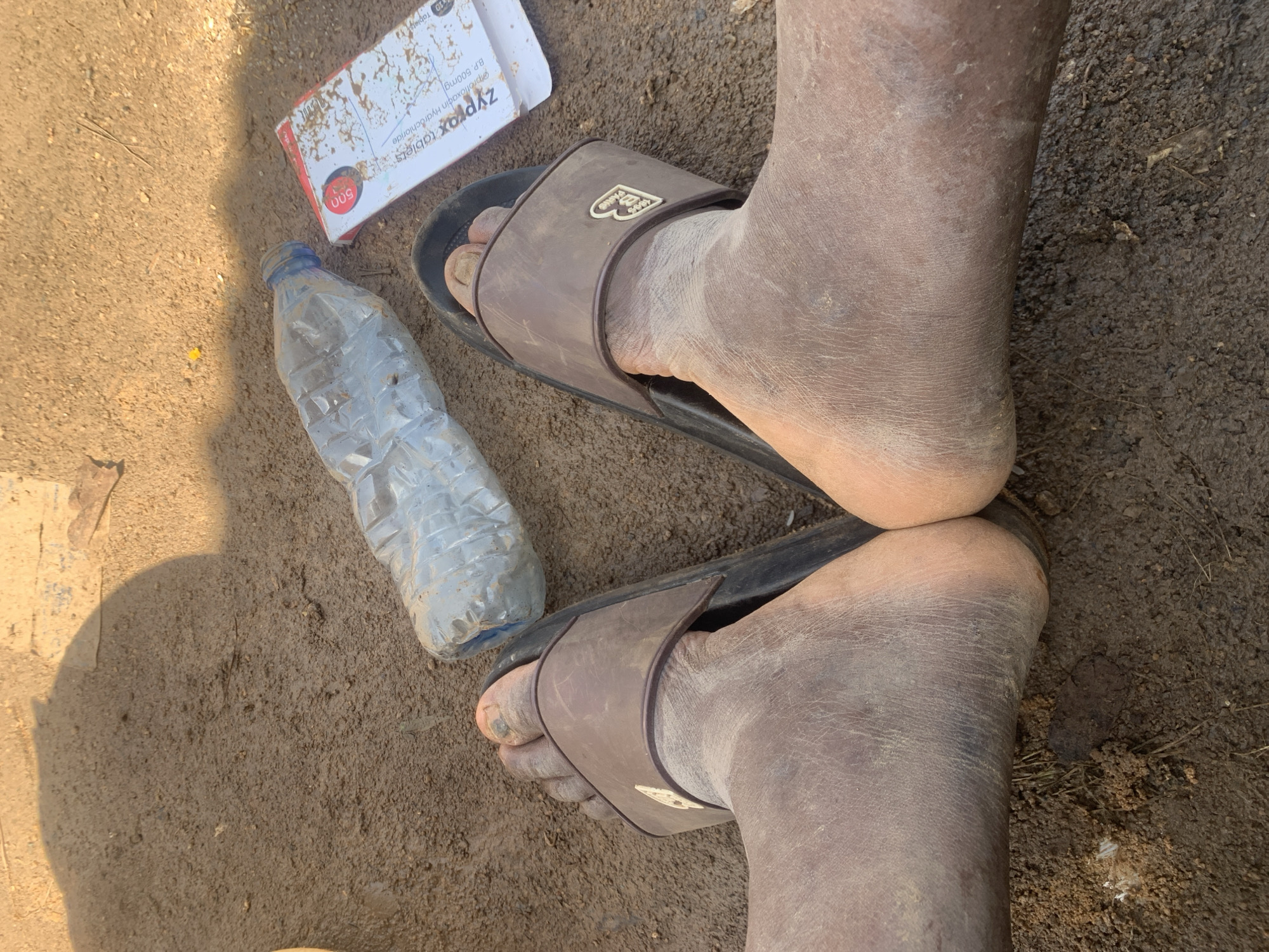 The image depicts a close-up view of a person's feet, wearing dirty brown slides, resting on muddy ground. To the left of the feet, a partially filled, crushed plastic water bottle lies on its side. To the right, a white and red box, appearing to be medication packaging, is also present on the ground. The environment is characterized by loose, damp soil, suggesting an outdoor setting, possibly in a rural or less developed area. The lighting indicates it is daytime, with a shadow cast from an unseen object in the upper left portion of the frame. The feet themselves are visibly dirty, covered in mud and dust. The medication box has text that is partially obscured but includes "Zypro" and "500mg," suggesting it contains antibiotics. The overall scene implies a moment of rest or pause in an environment where such conditions are present.