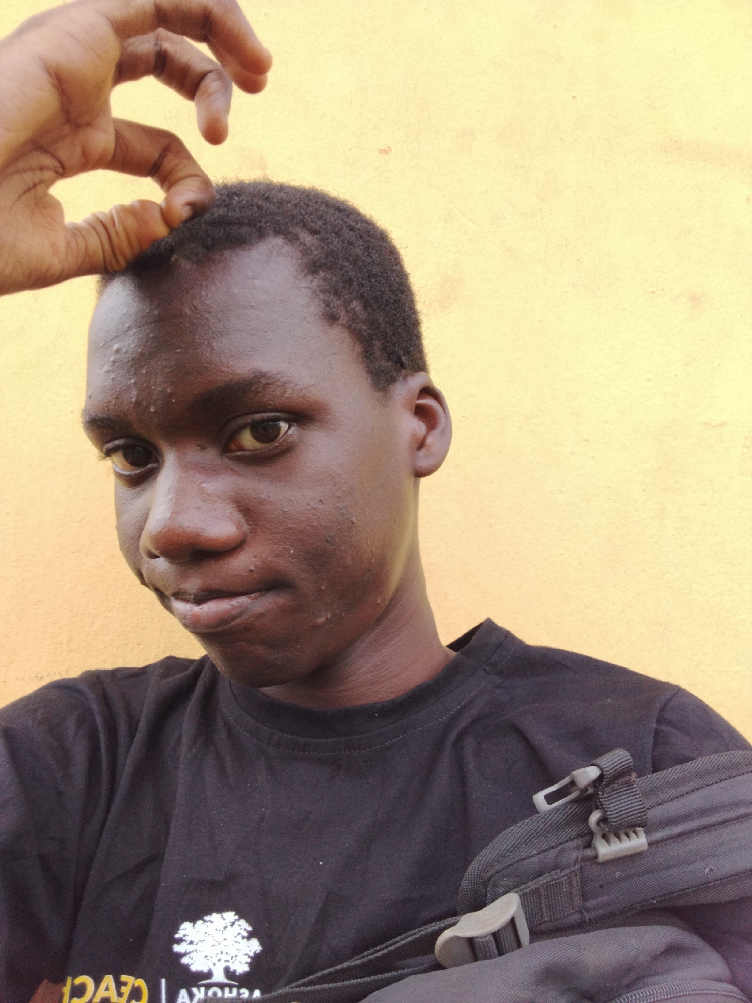 A close-up portrait captures a young person, likely male, with dark skin and short, dark hair, against a plain yellow wall. The subject looks directly at the camera with a thoughtful, slightly puckered expression. Their right hand is raised to their forehead, fingers curled, touching their hairline. Visible bumps or acne are present on their forehead and cheeks, and their skin exhibits a slight sheen.
The person is wearing a black t-shirt. On the chest, there's a prominent white logo depicting a tree with a full canopy. Below the tree, partial and reversed white text is visible, which appears to read "VEHOKV" and "D A Ɔ". A black bag with grey plastic buckles and textile straps is worn across the subject's body, visible in the lower right portion of the frame. The lighting suggests it is daytime.