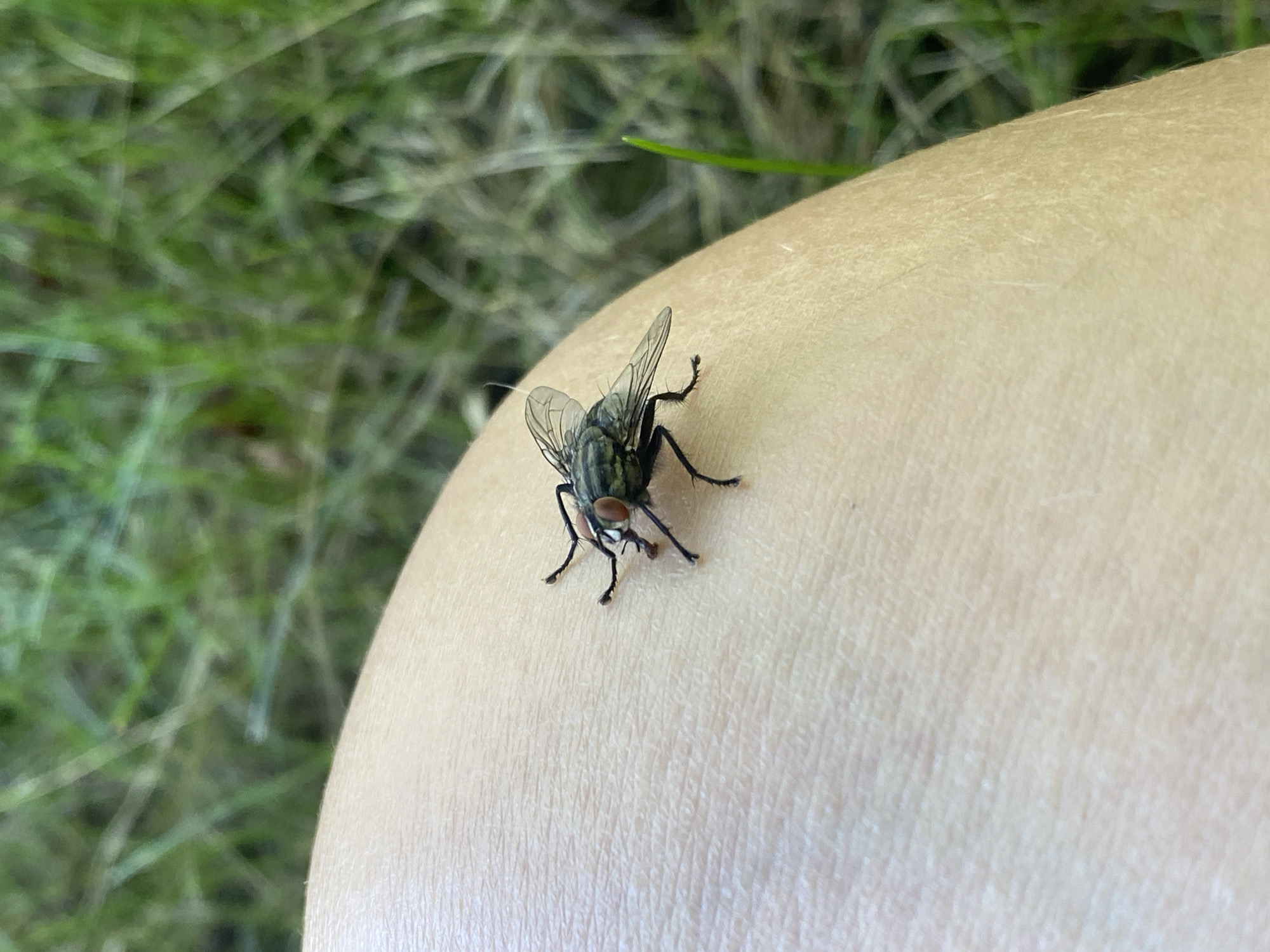 A close-up, high-angle shot captures a single housefly resting on a person's pale, lightly textured skin. The fly is positioned on the upper portion of the image, facing left. Its body is dark gray with iridescent green and blue hues, and its compound eyes are a striking reddish-orange. Its wings are transparent with visible veins, and its legs are black and hairy. The skin beneath the fly exhibits fine lines and pores. The background is blurred, showing a mix of green grass and out-of-focus foliage, suggesting an outdoor environment. There are no identifiable landmarks or indications of Anos, Russia.