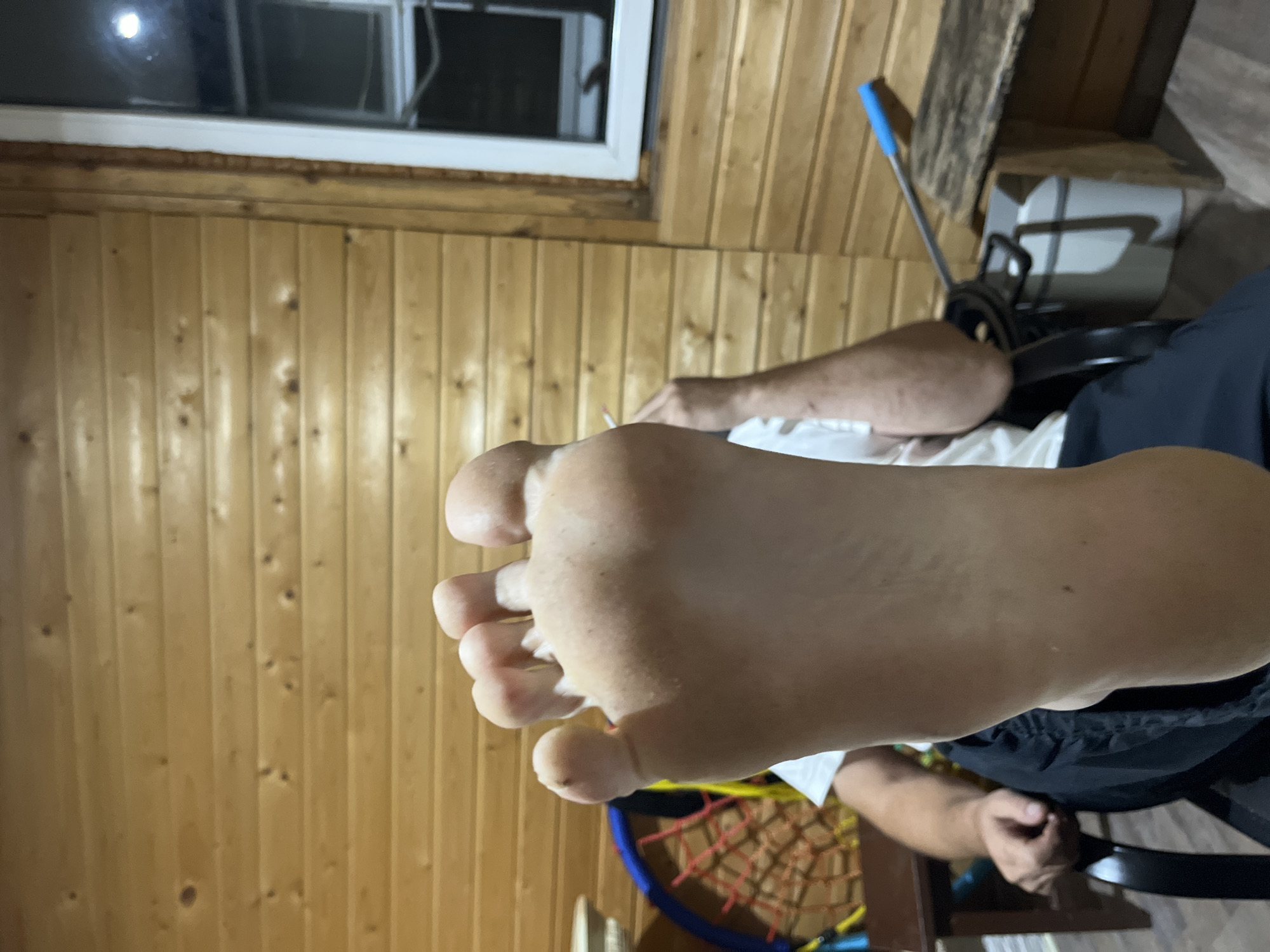 The image shows a close-up of a person's left foot, held up towards the camera. The foot is bare and appears to be resting on the person's lap or leg, as a portion of their body is visible in the background. The person is wearing a white t-shirt and dark pants. They are seated in a chair, which is partially visible on the left side of the frame. The environment appears to be indoors, with wooden paneling on the walls. A window with white trim is visible on the right side of the frame, and a light fixture is reflected in the glass. In the background, there is a colorful woven object and a bucket with a tool. The lighting is dim, suggesting it might be evening or night. There is no indication of the location being in the city of Saratov, Russia.