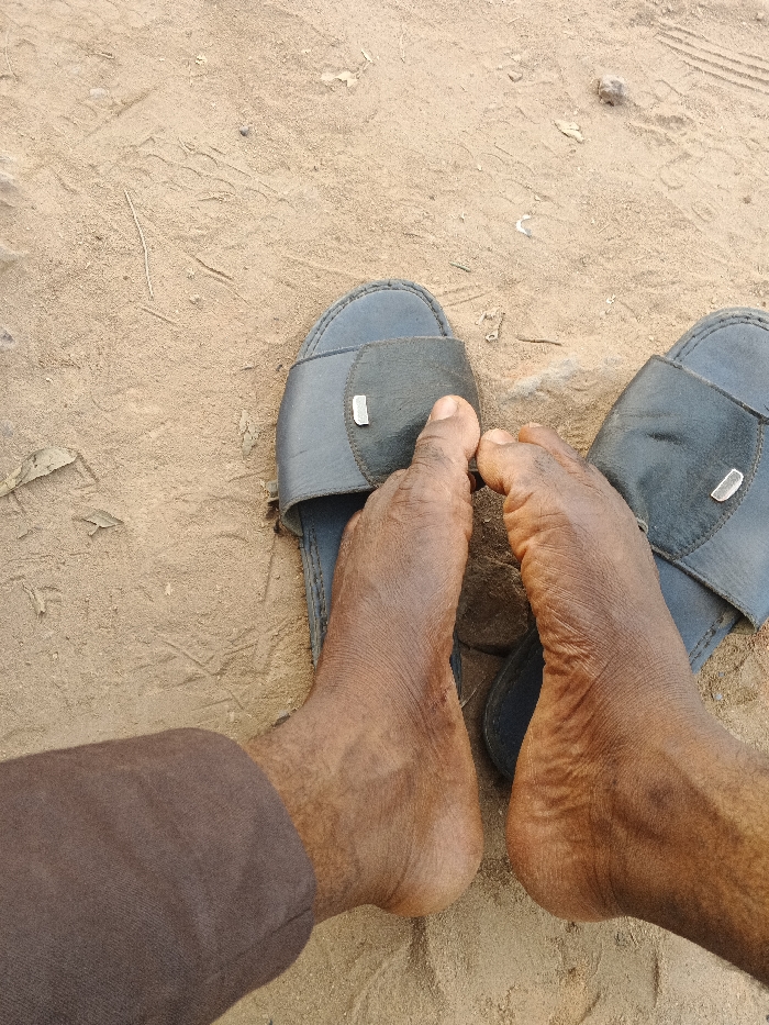A pair of dark-skinned feet are resting on sandals, placed on a sandy surface. The sandals are dark blue, with a simple strap design, each having a small metallic detail. The toes of the feet are visible, extending slightly beyond the edge of the sandals. The skin appears weathered, with visible wrinkles. A portion of a brown fabric can be seen in the lower left corner, suggesting clothing. The ground is dry, with sparse vegetation.