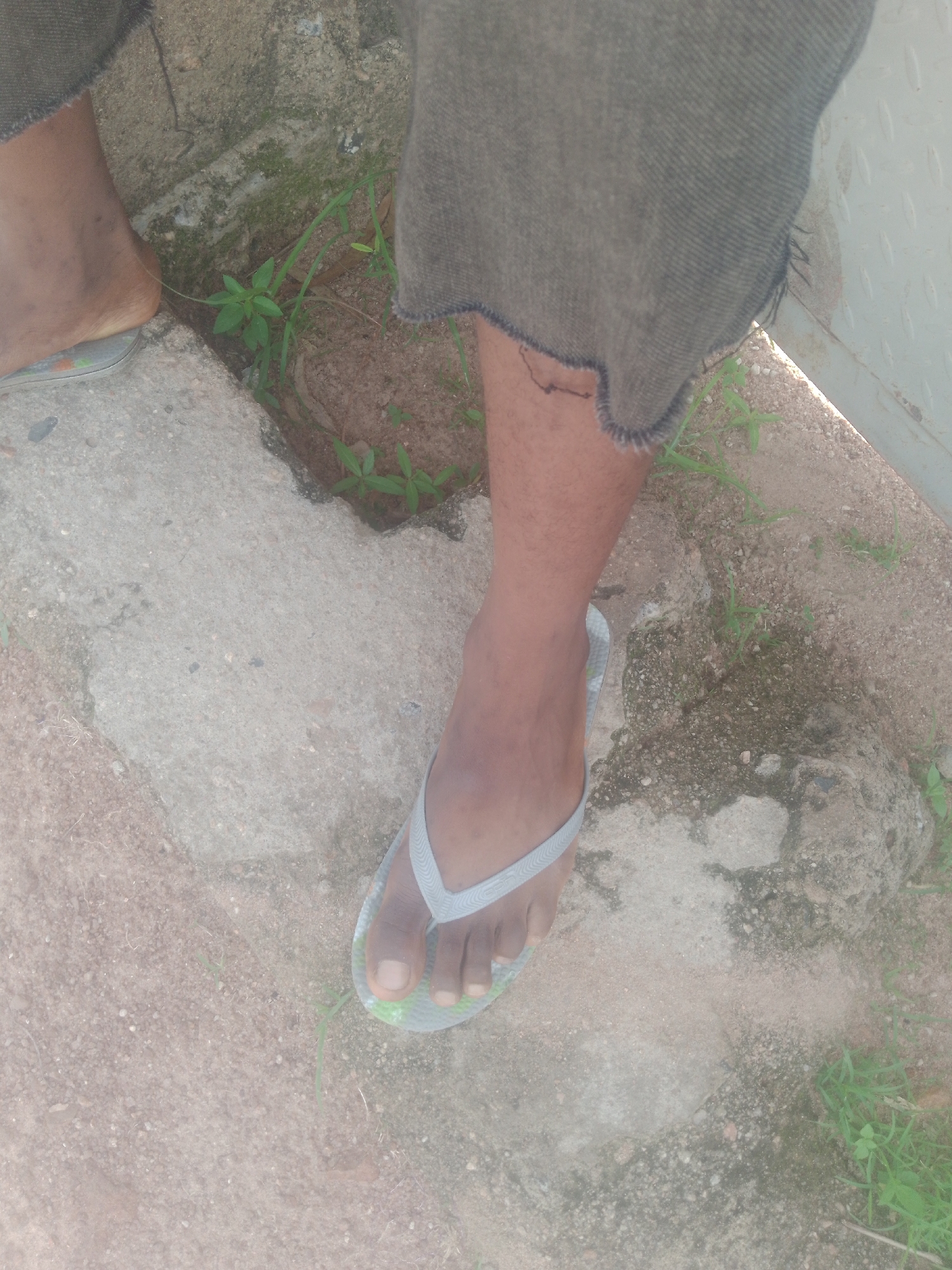 A person's left leg and foot, wearing a grey flip-flop, are visible from the knee down, standing on a textured concrete surface with patches of soil and sparse green vegetation. The person's trousers, made of dark fabric with frayed edges, cover the upper part of the leg. The scene appears to be an outdoor environment, possibly in Jauro Yinu, Nigeria, characterized by uneven ground and natural elements.