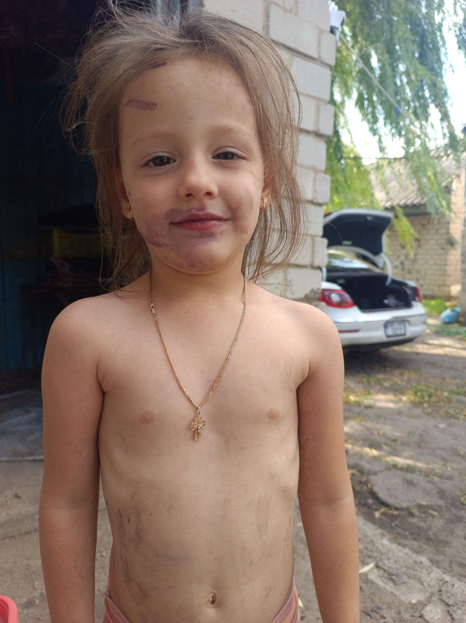 This media file captures a close-up, waist-up shot of a young girl with light brown hair, which appears somewhat tousled. She is looking directly at the camera with a slight smile. Her face shows some smudges of dark purple, particularly around her mouth and on her forehead, possibly from playing or eating. She is wearing a thin gold chain with a cross pendant. The girl's skin is fair, and her torso is bare, revealing some dirt smudges on her chest and abdomen.
The background suggests an outdoor setting in what appears to be a rural or semi-rural area. To the left, there's a dark, possibly wooden structure. To the right, a white car with its trunk open is visible, parked on a dirt or gravel area. Behind the car, a brick structure, likely a building, and some trees with green foliage are present. The lighting suggests it is daytime, possibly late morning or afternoon, with clear weather.
The overall impression is of a child who has been engaged in some outdoor activities, perhaps playing, given the dirt and smudges. The emotion conveyed is one of innocence and slight mischievousness. No visible text is present in the image. The location context provided is Saksahan, Ukraine.
