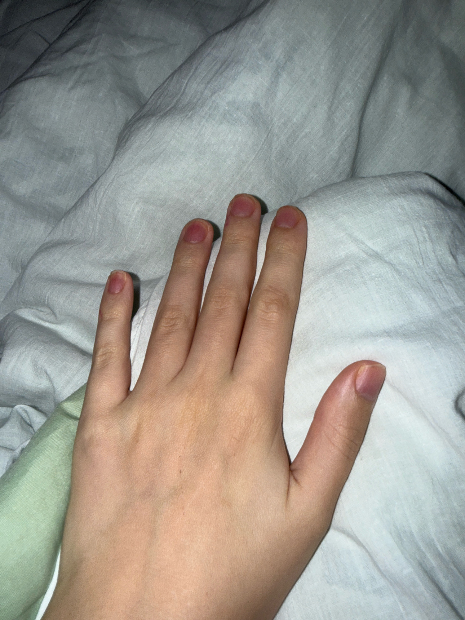 The image shows a person's left hand, fingers spread, resting on a wrinkled white fabric. A portion of a light green fabric is visible in the lower left corner. The lighting is dim, creating shadows on the fabric. The nails are short and unpolished. The skin tone is fair. The image does not contain any information or context related to the city of Zavolzhye, Russia.