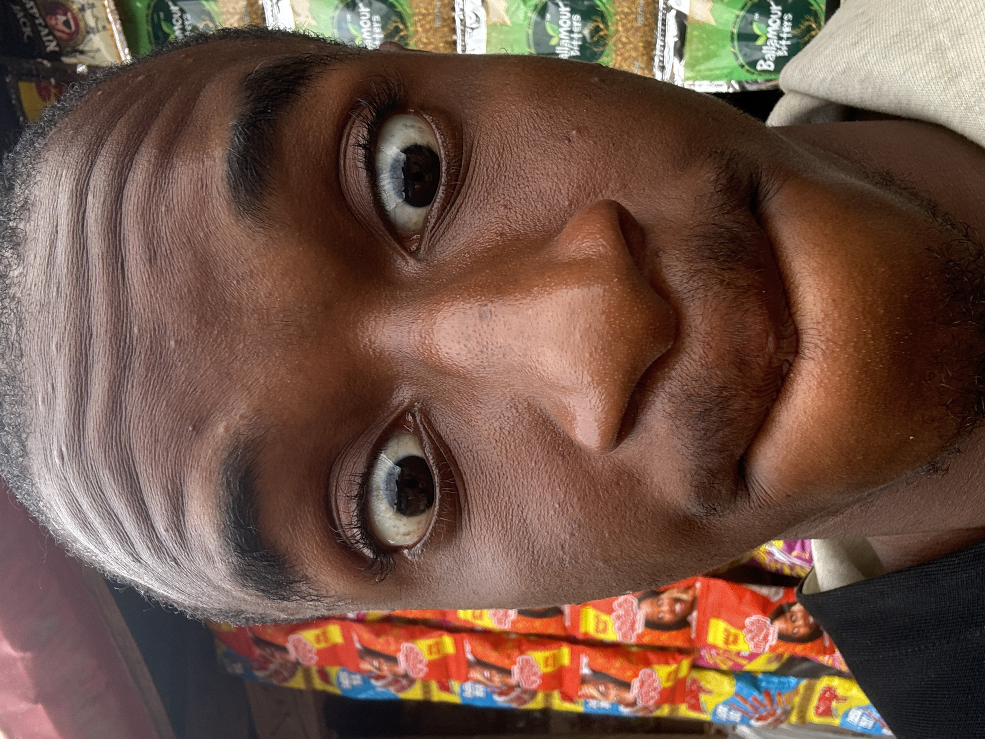 A close-up, head-on, eye-level, medium shot captures a Black male in Nkpor, Nigeria, with his face filling the frame. His eyes are wide and appear startled, with visible sclera and dark irises. His eyebrows are dark and slightly arched. His forehead displays pronounced horizontal wrinkles. A light stubble is visible on his upper lip and chin. His mouth is slightly pursed, with his lower lip appearing fuller than his upper lip.
Behind him, to his left, a rack of colorful snack packages is visible, predominantly in red and yellow with images of children's faces. To his right, several green packages with text that reads "Bellamours Bitters" are stacked. The lighting suggests an outdoor or semi-outdoor setting, possibly a market stall, with the sunlight creating subtle highlights on his skin. The background is somewhat blurred, drawing focus to the subject's face. The man is wearing a light-colored collar, possibly part of a shirt or jacket.