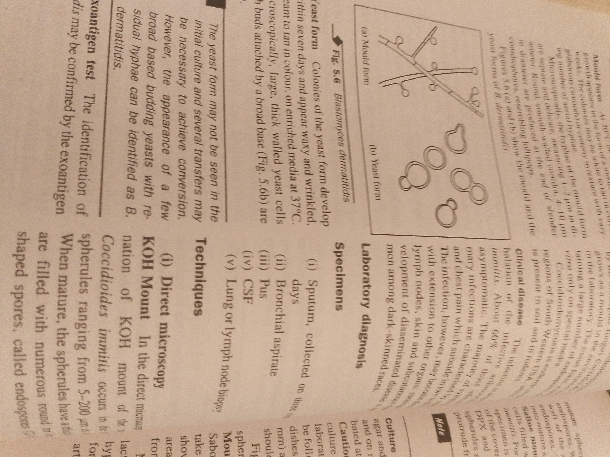 The image displays a page from a medical textbook or journal. The page contains text and illustrations related to mycology, specifically focusing on *Blastomyces dermatitidis*.
**Subjects:** The subjects are the text and the illustrations themselves. The text discusses the morphology and identification of the fungus. The illustrations depict the yeast and mold forms of *Blastomyces dermatitidis*.
**Objects:** The objects are the printed text on the page, diagrams of fungal structures, and the paper itself.
**Scene/Setting:** The scene is a document, likely a book or journal, open to a specific page. The text indicates that the subject matter is related to medical diagnosis and identification of fungal infections, suggesting a scientific or educational setting.
**Activity or Event:** The activity is reading and understanding scientific information. The text explains techniques for laboratory diagnosis and describes the characteristics of a fungal infection.
**Notable Details:**
* **Illustrations:** There are two key illustrations:
* Figure 5.6 (a) shows the "Mould form" with branching hyphae.
* Figure 5.6 (b) shows the "Yeast form" with multiple budding cells.
* **Textual Content:** The text details the appearance of yeast and mold colonies, microscopic characteristics, and methods of diagnosis. It mentions "KOH Mount," "Direct microscopy," "Sputum," "Bronchial aspirate," "Pus," "CSF," and "Lung or lymph node biopsy" as relevant techniques and specimens. It also discusses the clinical disease caused by the fungus, emphasizing its prevalence in soil and in rodents, and its potential to cause disseminated disease in humans.
* **Textual Excerpts:** Key phrases visible include "Blastomyces dermatitidis," "Colonies of the yeast form," "Yeast form," "Mould form," "The yeast form may not be seen in the initial culture," "The identification of B. dermatitidis," "The infection," "Clinical disease," "Laboratory diagnosis," and "Techniques."
**Location Context:** The provided location context of Jauro Yinu, Nigeria, is not directly evident from the image content itself. The text refers to "regions of South Western USA" and "soil and in rodents," suggesting a geographical context related to the fungus's natural habitat, but not directly to the current physical location of the document.
**Time of Day/Weather/Emotions:** None of these elements are discernible from the provided image, as it is a static representation of printed material.