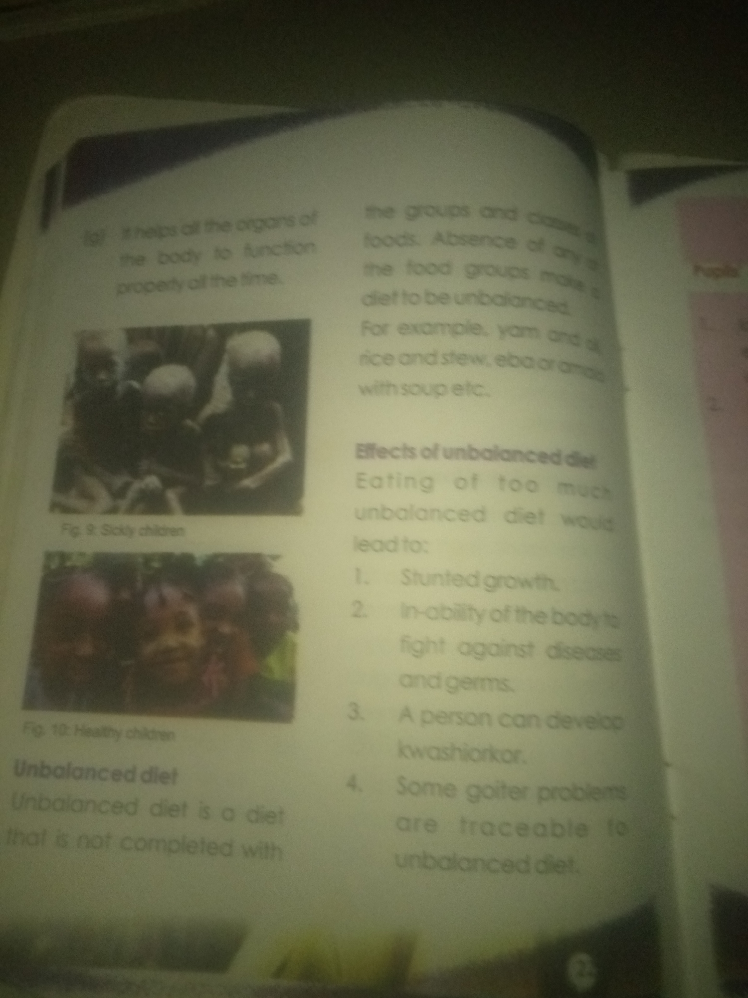 The image is a close-up of an open book, showing text and two photographs. The book appears to be educational, likely for children, with headings such as "Effects of unbalanced diet" and "Unbalanced diet." The first photograph, labeled "Fig. 9: Sickly children," shows a group of emaciated children with skeletal features, suggesting malnutrition. The second photograph, labeled "Fig. 10: Healthy children," depicts a group of children who appear well-nourished and happy. The text discusses the importance of a balanced diet and the consequences of an unbalanced diet, including stunted growth and diseases like kwashiorkor. The overall scene is a page from an informative book, likely discussing health and nutrition, with visual aids illustrating the effects of diet on children's well-being.