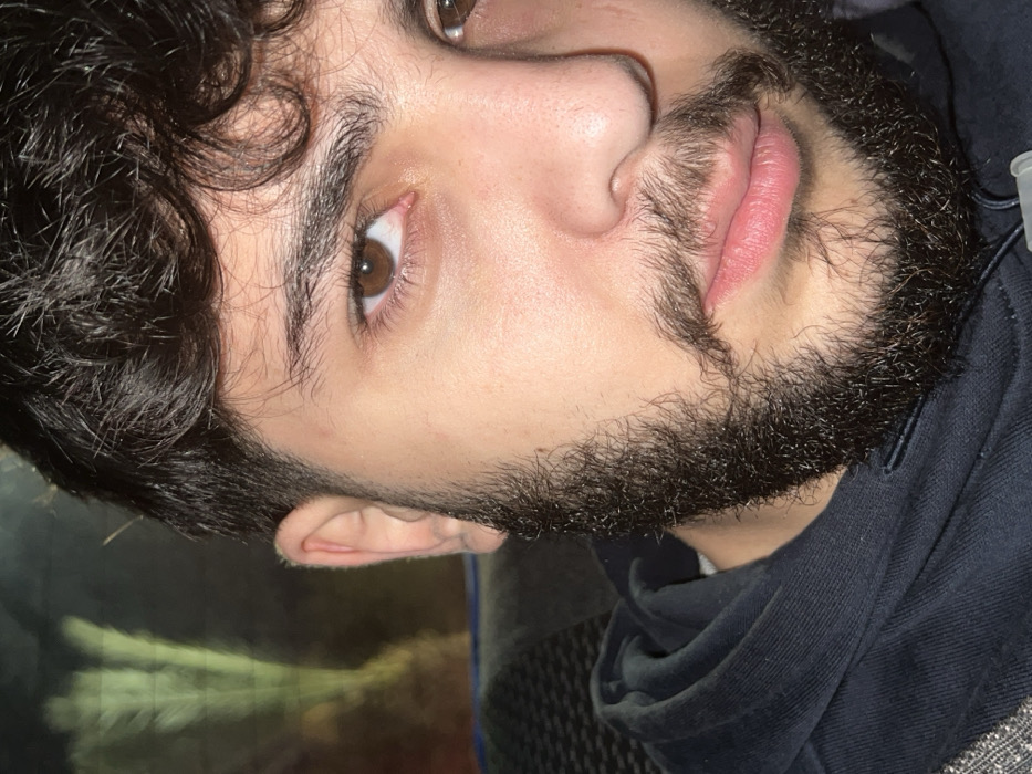 A young adult male is depicted in a close-up portrait, oriented forward and looking directly into the camera. He has fair to olive skin, dark brown curly hair, and a full, dark brown, curly beard and mustache. His eyebrows are thick and dark, and his eyes are dark brown; the sclera of his right eye shows minor redness. His nose is prominent, and his lips are full and closed. He is wearing a dark blue or black hooded sweatshirt. The background is out of focus, dark, and contains blurry, elongated, light-colored reflections with a greenish-yellow tint in the upper left, suggestive of foliage or an external light source viewed through a window. The environment provides no discernible specific identifying features to confirm a location such as Al-Muhajerin Municipality, Syria. The individual is static, posing for the image. No other subjects or interactions are present.