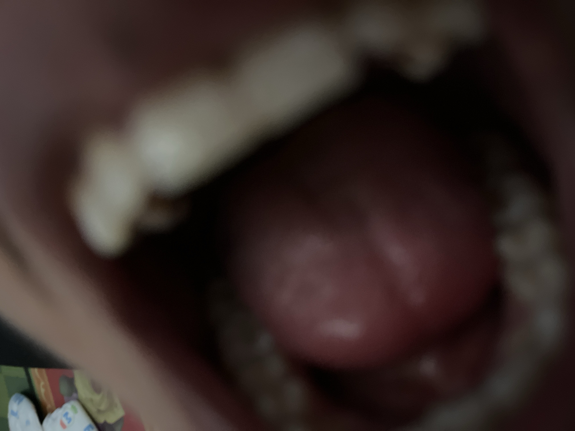 The image shows a close-up, out-of-focus view inside an open mouth. A large, pink, bulbous object, likely a tongue, is the central focus. Several teeth, appearing yellowish and uneven, are visible along the edges of the mouth, suggesting they are the upper and lower molars. The lighting is dim, creating shadows and obscuring fine details. The background is dark and indistinct. There is no discernible information about a location in Benuaraja, Indonesia, or any other specific environmental details.
