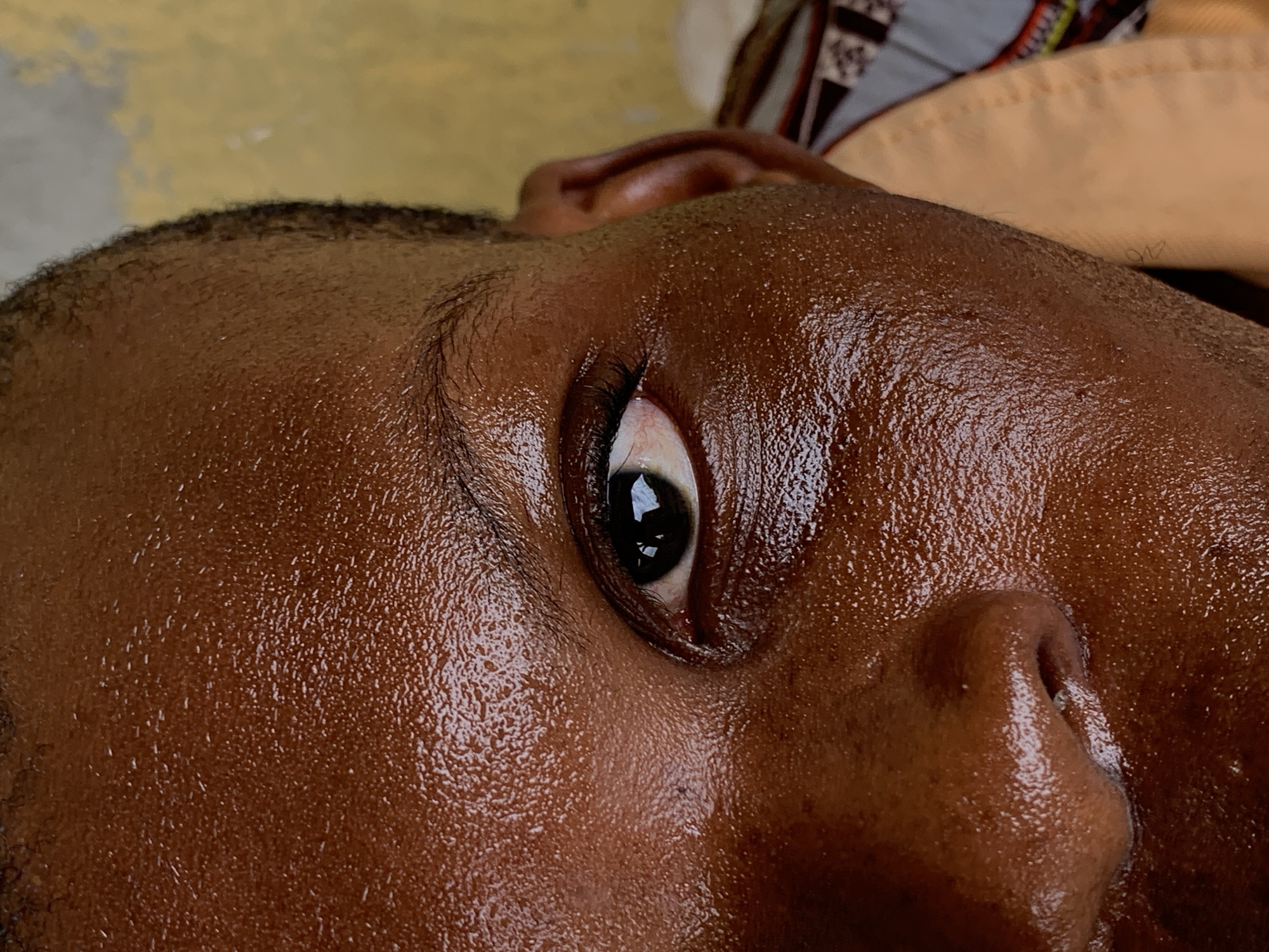 Close-up, tilted perspective of a person's face, likely male, with dark brown skin glistening with moisture. The eye is open and gazing upwards, reflecting light. Visible facial features include the eyebrow, eyelashes, part of the ear, and nose. The skin texture appears smooth with visible pores and moisture droplets. The background is slightly blurred, showing parts of a patterned cloth and what seems to be a concrete surface. The location of Ikorodu, Nigeria, is not apparent from the image alone.