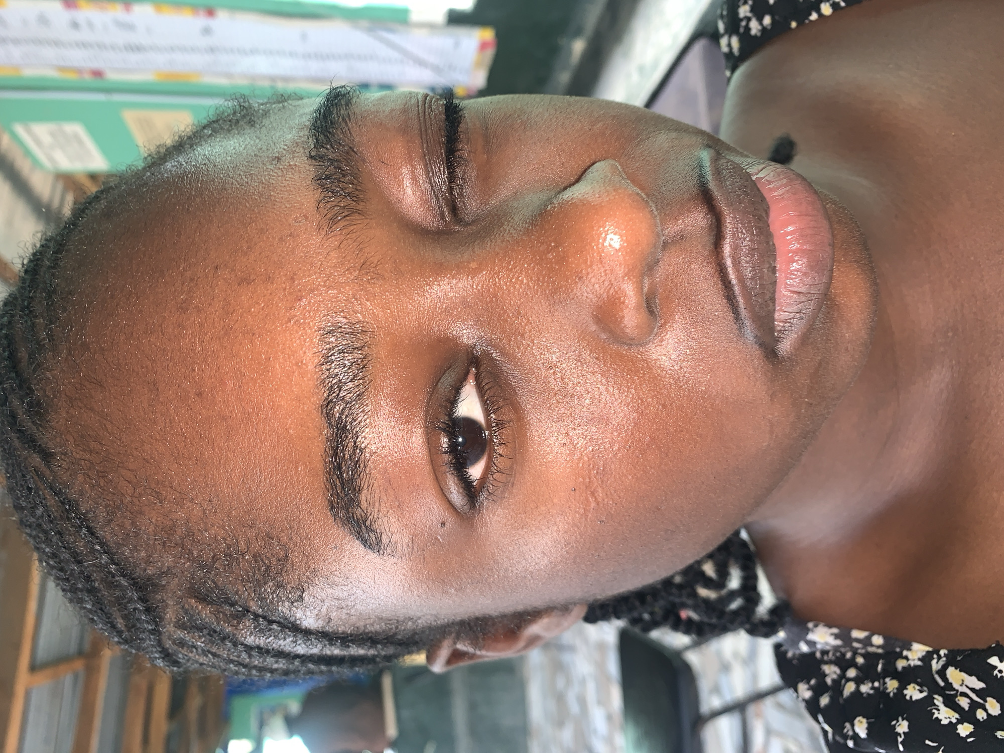 The image is a close-up, vertical portrait of a young Black female. Her head is tilted, with her right eye (viewer's left) partially open, revealing a dark brown iris. Long, dark eyelashes frame both eyes, and her eyebrows are dark and well-defined. Her skin is a dark brown complexion, appearing smooth and well-hydrated with a subtle sheen, particularly on her forehead, nose, and cheekbones. Her lips are full, showing a natural pinkish-brown tone with visible texture and slight chapping. Small moles are present on her upper lip area and below her partially open eye.
Her hair is styled in neat, small cornrows that frame her face, with fine, short dark hairs visible along her hairline on her forehead. She is wearing a garment with a black background featuring a small, delicate white and yellow floral pattern, visible around her neck and shoulder.
The background is softly blurred, indicating a shallow depth of field. It shows indistinct shapes and colors, including light green, white, and grey tones, suggestive of an indoor or covered setting, possibly with shelves or light fixtures in the distance. The lighting appears bright and even. No discernible activity is taking place other than the portrait itself, which conveys a calm or contemplative expression. There is no visible text. The location context is New Stadium, Nigeria.