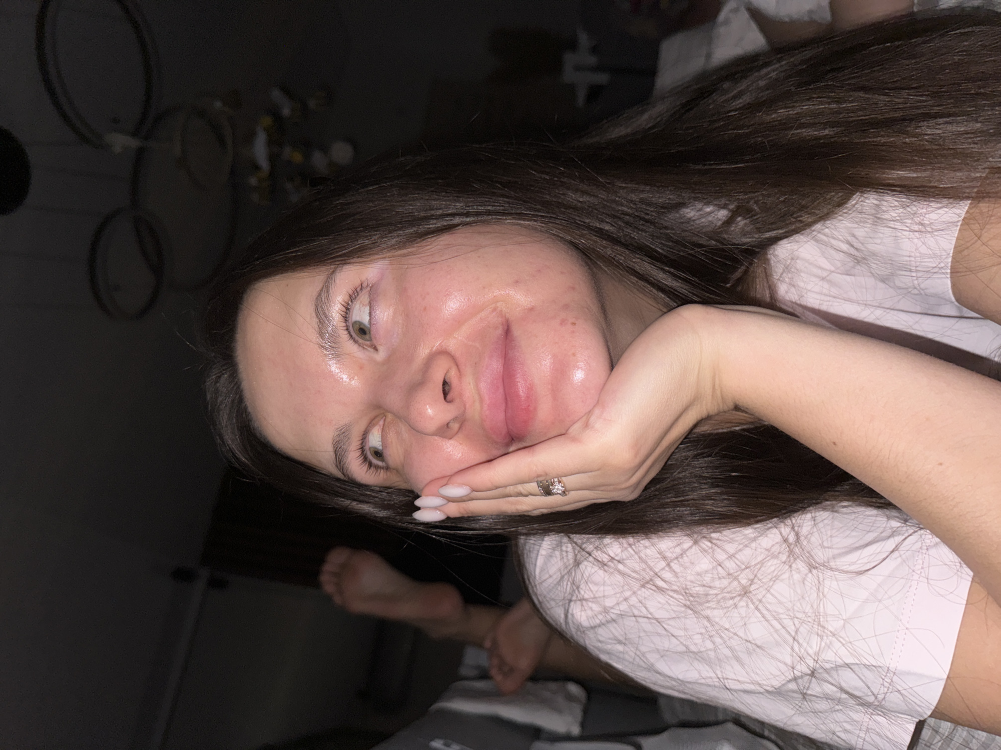 A young person with long, dark brown hair and light-colored eyes is depicted in a casual, indoor setting, likely Akulovo (Gp Kubinka), Russia. They are lying down, wearing a light-colored t-shirt, and posing for the camera with their right hand resting under their chin. A ring with multiple bands is visible on their right ring finger, and their fingernails are painted with a light polish. Their skin appears somewhat shiny with visible blemishes and redness. In the background, their bare feet are visible, elevated. The lighting is dim, suggesting it is evening or night. Blurry shapes in the background might be decorative elements or light fixtures. The person has a relaxed, possibly playful expression.