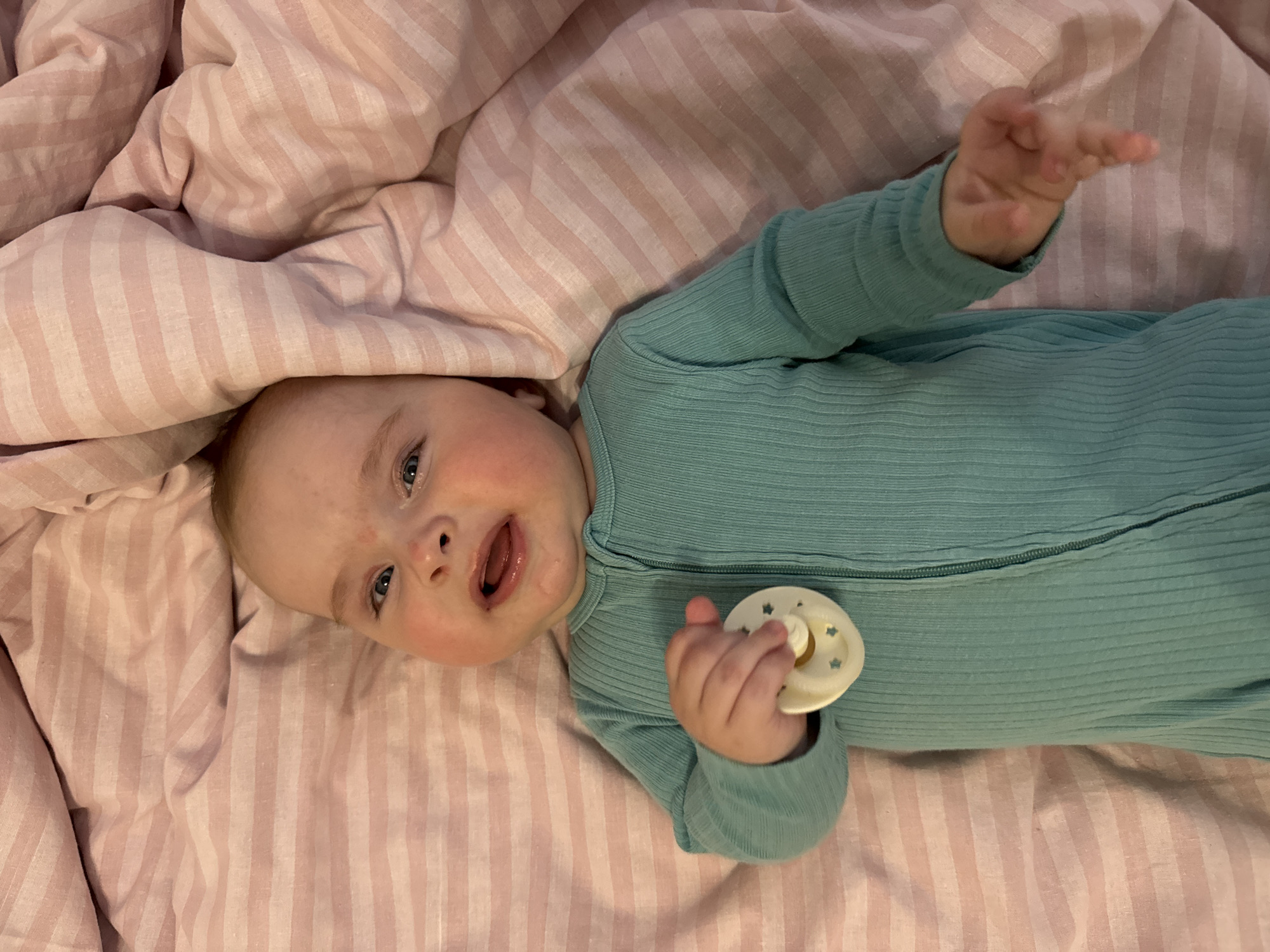 A baby lies on a pink striped blanket, wearing a teal zippered onesie and holding a pacifier. The baby's eyes are open, and their mouth is slightly ajar. Red marks are visible on the baby's cheeks and nose. The blanket is wrinkled and bunched up around the baby.