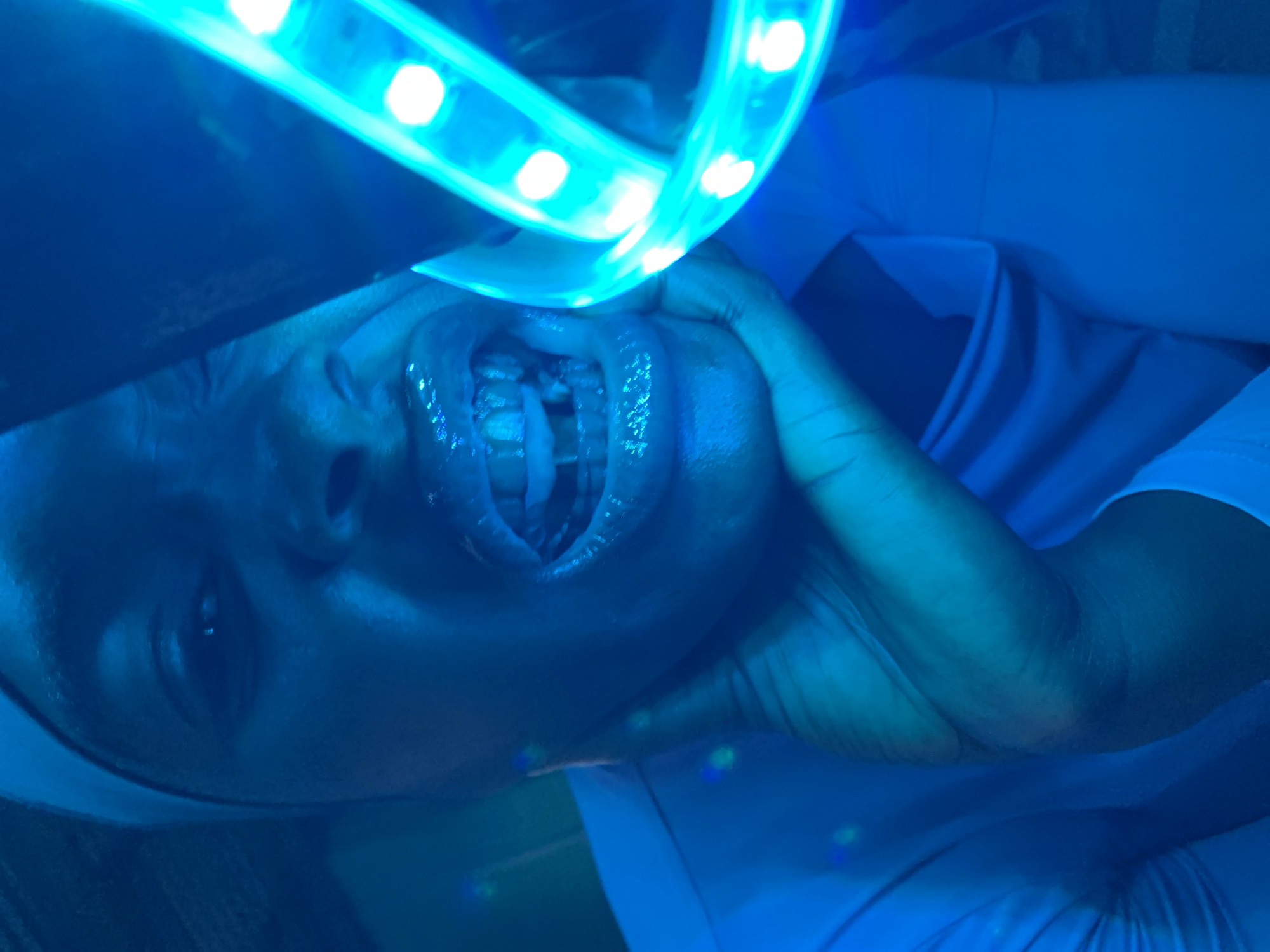 A person, possibly female, is under a blue light, likely from an LED light source. Their mouth is open, revealing teeth. One hand is on their cheek. The environment is dark, with some material appearing to be fabric in the background. Location unspecified in image data. There's no confirmed evidence to suggest the location is New Stadium, Nigeria. The image provides insufficient information for location inference.