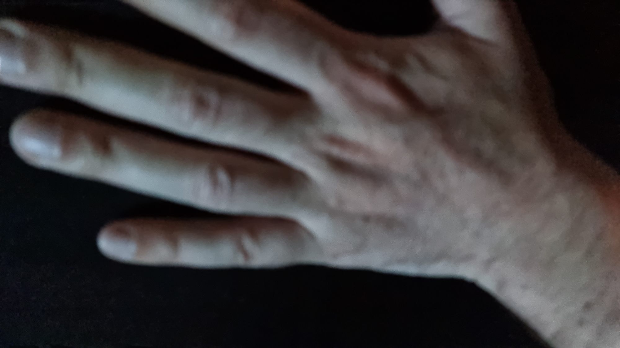 The image shows a close-up, blurry, low-light, and slightly overexposed view of a person's left hand. The hand is held against a dark background, obscuring any environmental context that might suggest a specific location, including the city of Tbilisi, Georgia. The hand is oriented with the palm facing downwards and slightly towards the viewer. The fingers are extended and slightly splayed, with the thumb not visible. The skin tone appears fair, and there are visible veins and some subtle shadowing on the knuckles and between the fingers. The overall impression is of a candid, unposed snapshot where the primary subject is the texture and form of the hand itself. The lack of discernible background elements makes it impossible to determine the location.