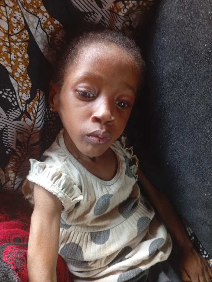 A young, dark-skinned child with a serious expression looks at the camera. They wear a light-colored dress with dark polka dots and ruffled sleeves. An earring is visible in their left ear. The child is seated, and the background includes a dark-colored wall or fabric to the right, and a patterned fabric to the left, with a red blanket below. The child appears frail, with thin arms.