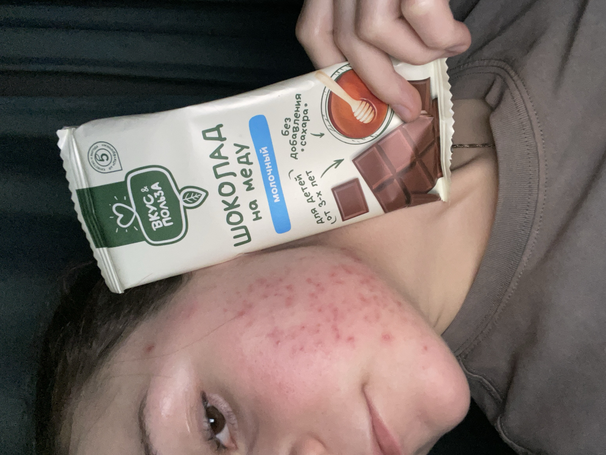A close-up, rotated shot captures a person holding a white and green packaged chocolate bar near their face. The person, whose facial features suggest they are female, is lying down, possibly on a bed or couch, with a dark, indistinct background behind them. They are wearing a grey t-shirt or sweatshirt, and a thin chain necklace is visible around their neck.
A prominent detail is the widespread presence of numerous small red spots, consistent with acne or a rash, covering the person's cheek and forehead. Their facial expression is neutral, with their brown eye looking towards the viewer.
The chocolate bar packaging is a central object. Visible text includes the brand name "ВКУС & ПОЛЬЗА" (Taste & Benefit) in green. The product is identified as "ШОКОЛАД на меду" (Chocolate with honey) and "молочный" (milk chocolate). Key claims on the wrapper state "без Добавления сахара" (without added sugar) and "для детей от 3-х лет" (for children aged 3+). An illustration on the packaging shows a honey dipper with honey and pieces of chocolate. A logo containing the number "5" and the partially visible text "Пятёрочка" (Pyaterochka) suggests the product's origin or retail association. The person's hand, with manicured nails, holds the chocolate bar, which appears slightly opened at one end. The overall lighting is soft, likely from an indoor source.