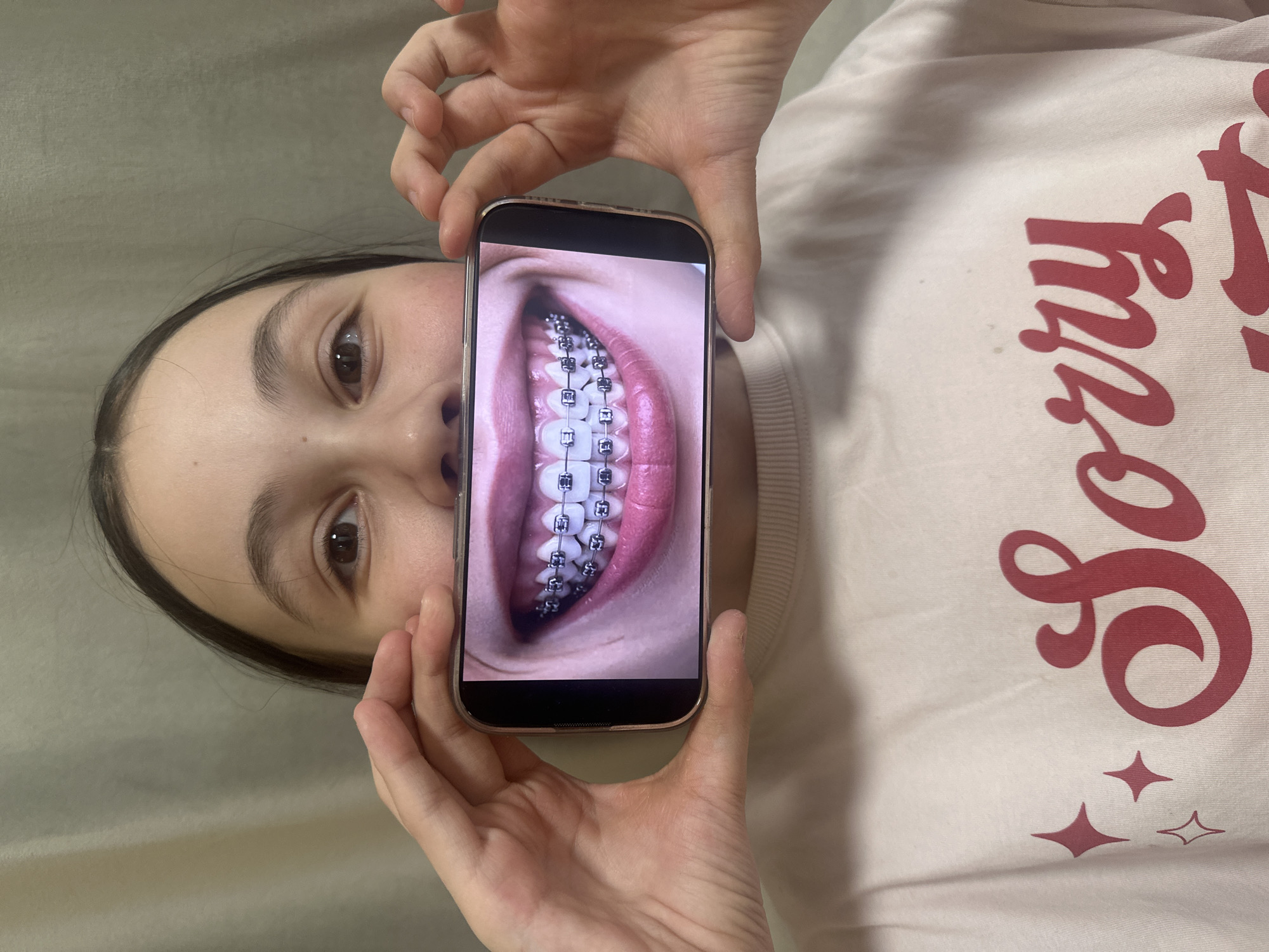 A young person is shown indoors, holding a smartphone with both hands in front of their face. The image is rotated 90 degrees counter-clockwise, positioning the person's head on the left side of the frame and their torso on the right.
The central focus is the smartphone, which displays a vivid, close-up image of an open mouth. Within this image, both the upper and lower teeth are clearly visible, fitted with traditional metal braces. The surrounding gums and inner lips are also depicted in detail on the phone's screen.
The person holding the phone has dark hair, dark brown eyes, and a neutral or focused expression. They are wearing a light-colored, possibly cream or off-white, long-sleeved top. Visible on the right side of the shirt is part of a red word, "Sorry," accompanied by small red star-shaped graphics. The background is a plain, light-colored surface, likely a wall or fabric.
The activity suggests the person is either displaying or looking intently at the image of the braced teeth on their phone, perhaps for a comparison or to show off orthodontic work. The scene appears casual and takes place indoors. This specific location is Votkinsk, Russia. The time of day cannot be determined from the indoor lighting.