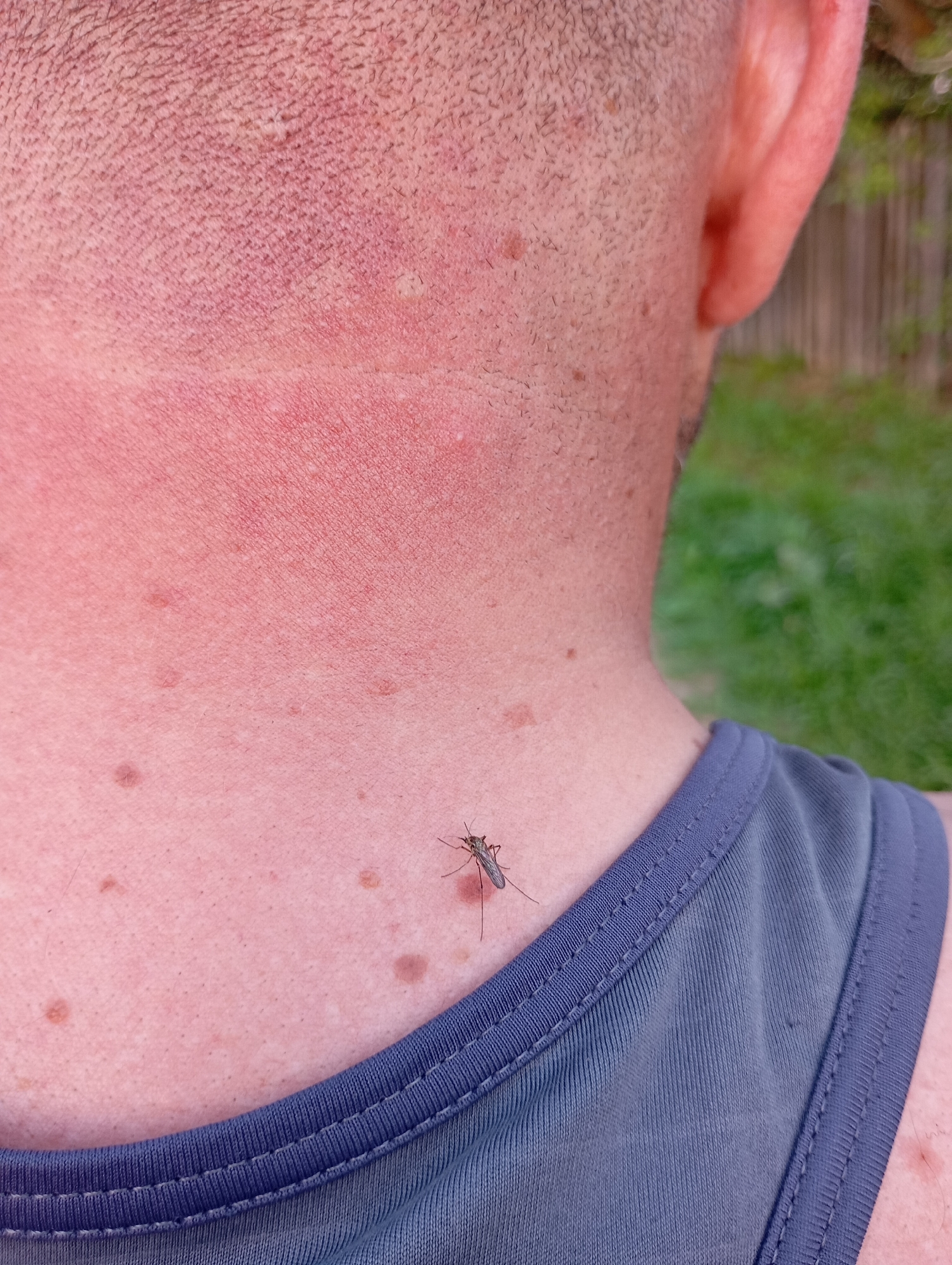 The image shows the back of a person's neck and shoulder, with a mosquito biting the neck. The person's skin is fair and has several freckles and a sunburn pattern. The mosquito is dark-colored with long legs. The person is wearing a gray tank top. The background is slightly blurred but appears to be outdoors, with green foliage visible. The location is Unknown, Unknown.