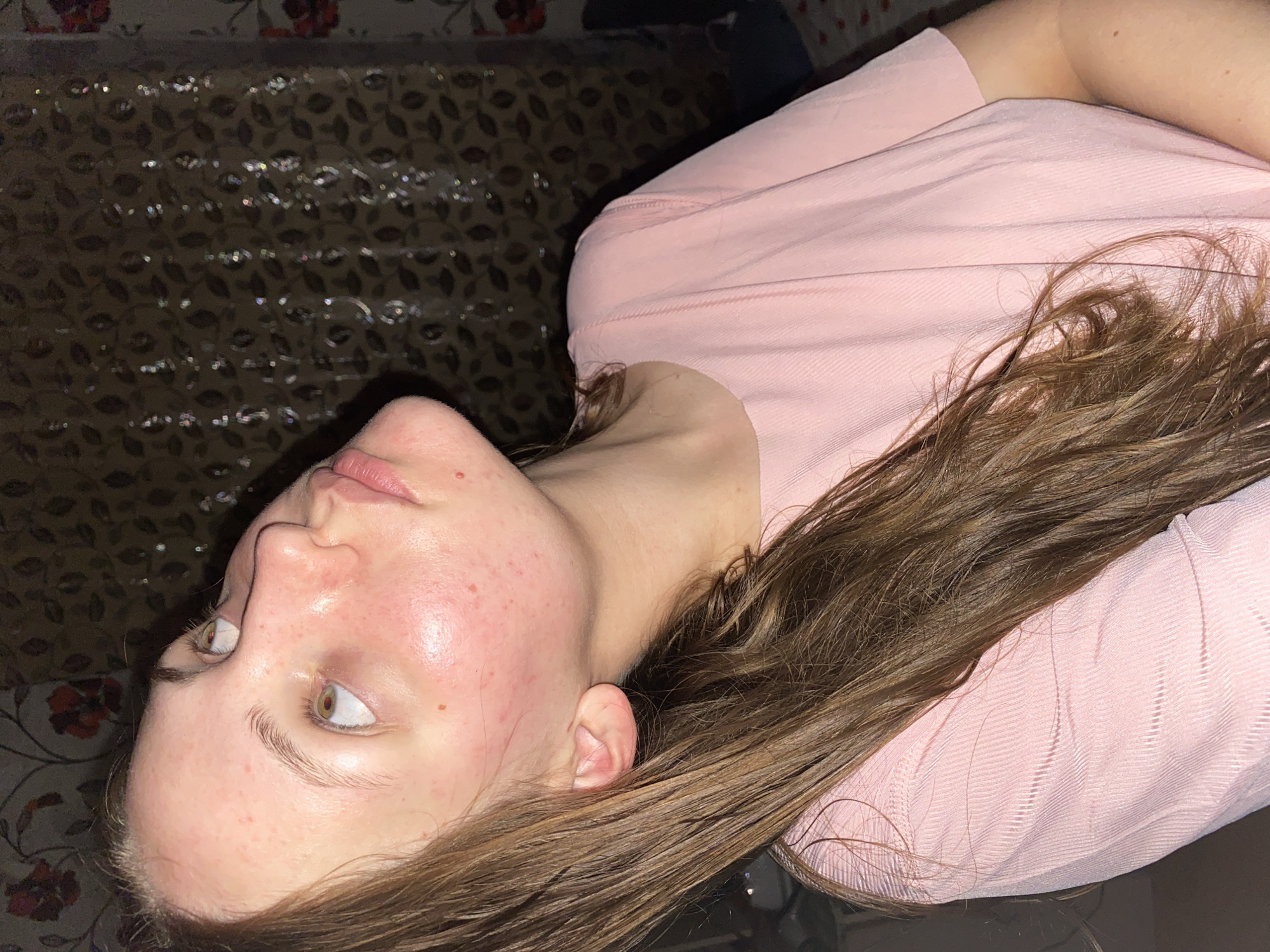 A young woman with long, brown hair is positioned on the right side of the frame, with her head tilted back and looking upwards. She is wearing a light pink, ribbed t-shirt. Her skin is visible on her face and neck, showing some redness and blemishes. The background consists of a patterned curtain with floral motifs, and the lighting appears to be dim, casting a shadow. No specific location in Vasyutina, Russia is identifiable from the image.