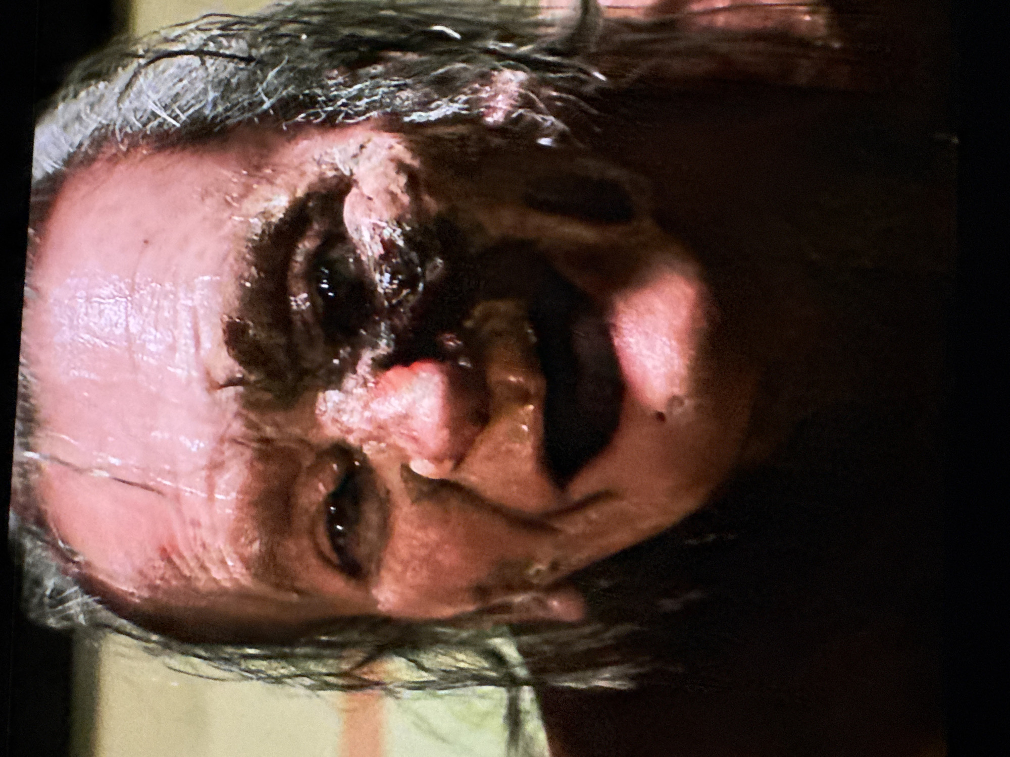 A close-up, slightly rotated image shows an older person's face, partially obscured by shadows. The person has graying hair and visible skin damage or disfigurement around the eye area. The skin appears moist or oily. The overall scene is dark, with limited ambient light and no clear indication of location. The environment is vague and unidentifiable. There is no observable action or interaction.