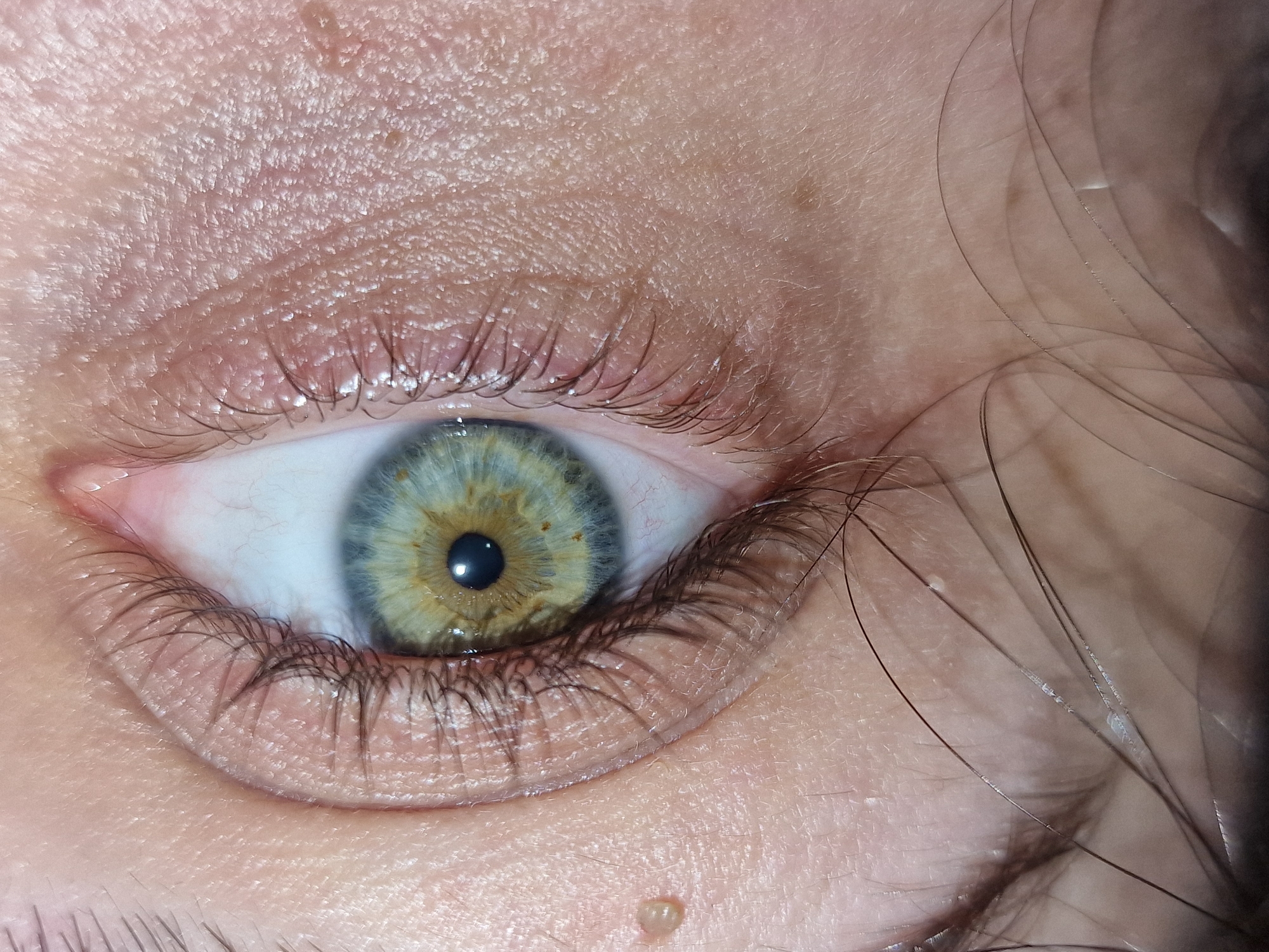 A close-up image features a human eye with a central pupil, surrounded by a heterochromatic iris exhibiting hues of blue, gray, and yellow-brown. The eyelids and eyelashes are visible, along with the surrounding skin, which displays textures and some minor skin imperfections. Loose strands of hair are present on the right side of the image. The location is not identifiable within the image.
