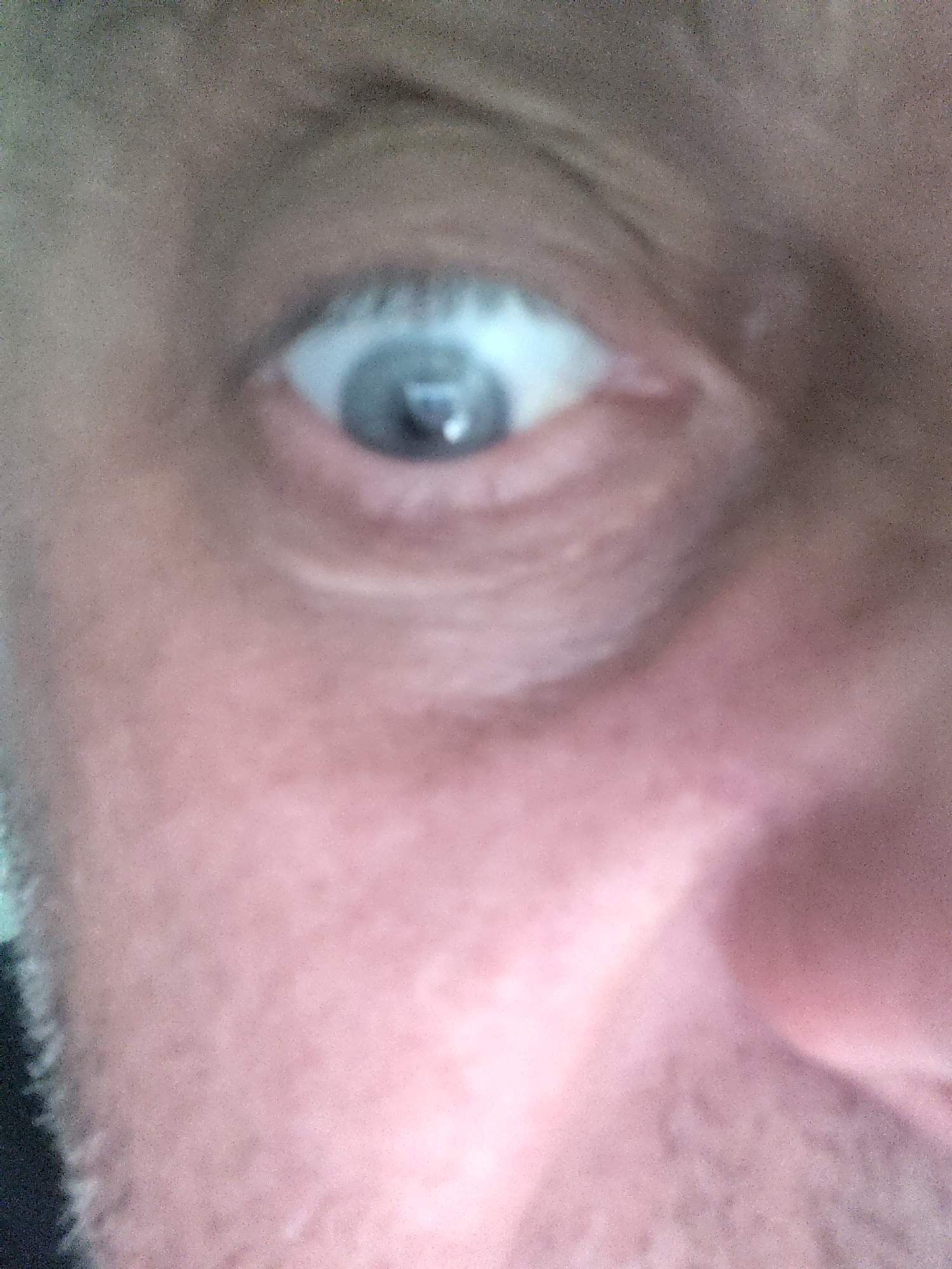 The image is a grainy, out-of-focus close-up of a human eye and adjacent facial features. The eye exhibits a light blue iris and a dilated black pupil, reflecting a distinct circular light source. The sclera is visible above and below the iris, indicating the eye is wide open. The surrounding skin appears light-toned, showing texture, pores, and some pinkish undertones. A blurred section of the nose is partially visible in the lower right, and faint stubble is discernible along the left edge of the frame. No other individuals, objects, actions, or environmental context, including geographical location in Huntingdonshire, United Kingdom, are discernible within this limited perspective.