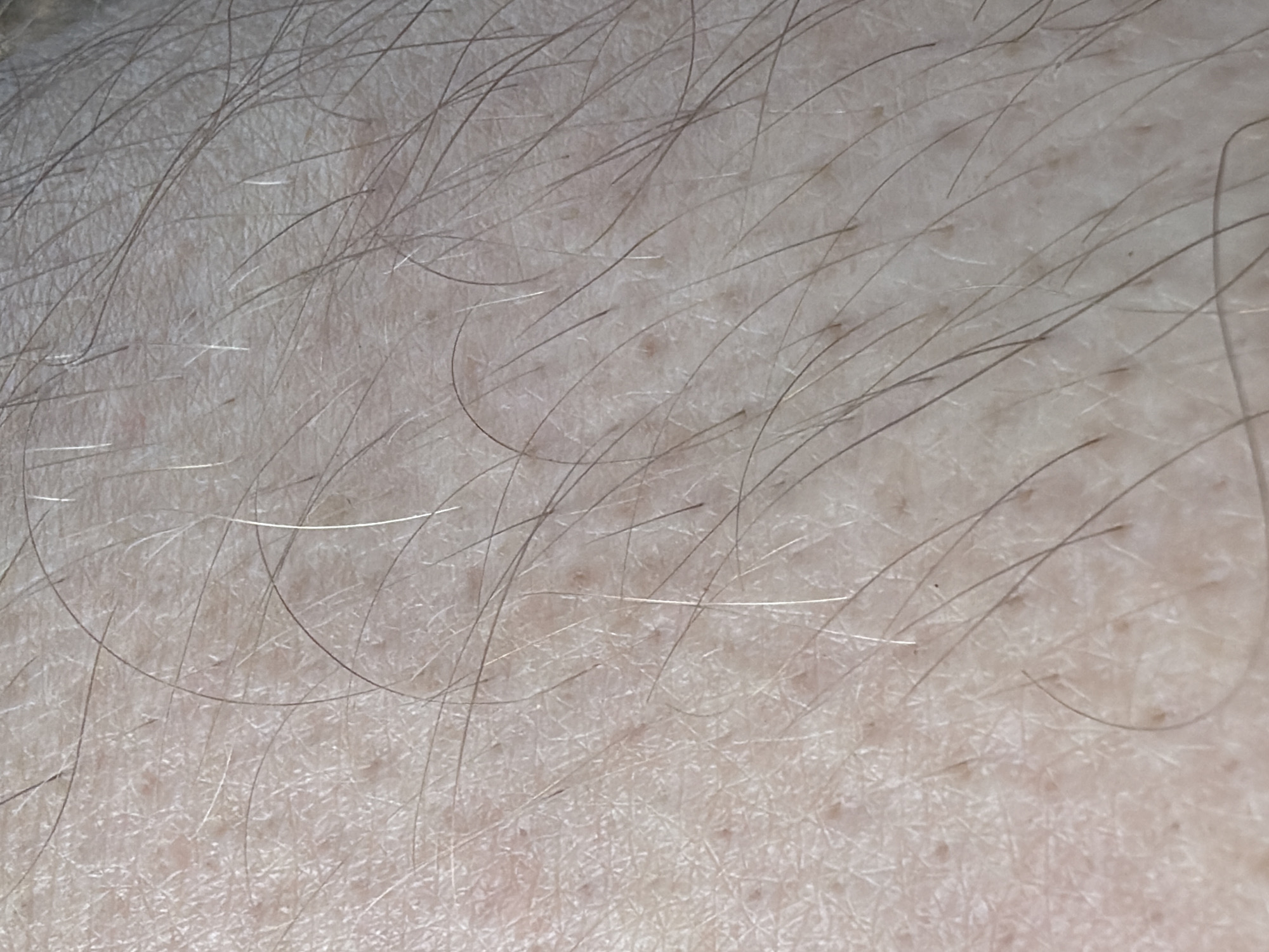 The image is a close-up, high-angle shot of human skin with sparse, light-colored hair. The skin texture is visible, showing small pores and a slightly uneven surface. The lighting appears to be natural, highlighting the fine details of the skin and hair. There are no discernible features indicating a specific location within Orenburg, Russia, as the image focuses solely on a small section of skin.
