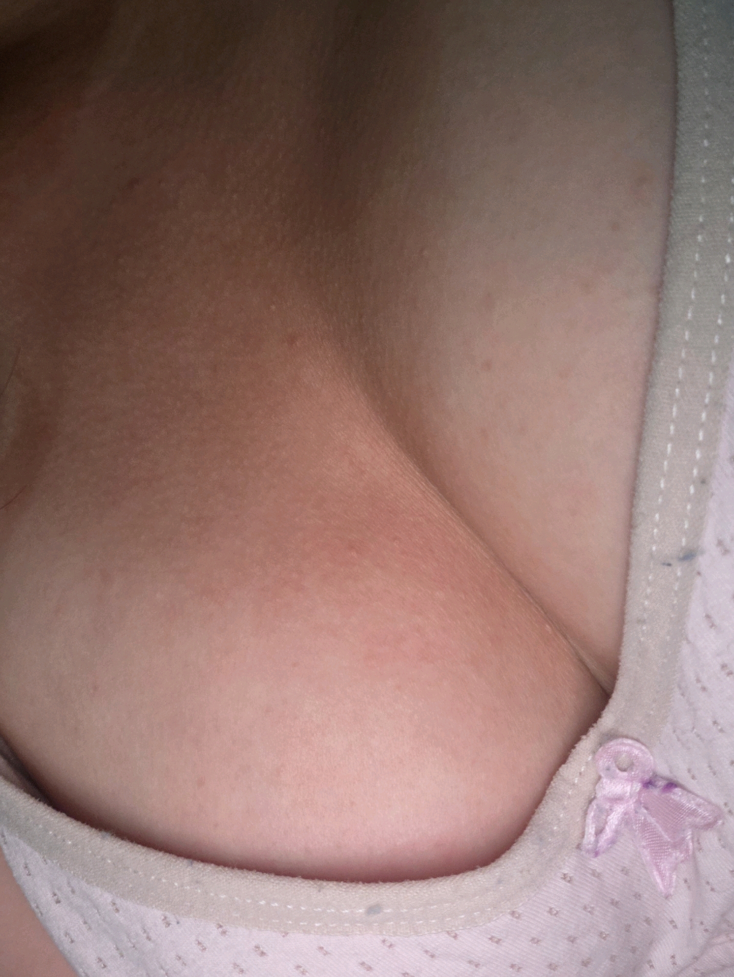 The image is a close-up shot of a person's chest area, specifically the décolletage, wearing a light pink, patterned garment with a delicate white trim and a small pink bow. The skin appears fair with some subtle redness, possibly indicating a tan or irritation, and a few small, dark freckles are visible. The garment's fabric has a subtle texture, and the stitching along the trim is noticeable. The lighting suggests an indoor setting or an overcast day, as there are no harsh shadows. No specific activity is depicted, and the focus is solely on the texture and color of the skin and fabric. There is no visible text in the image. The context of Phan Thiết, Vietnam, does not provide any direct visual cues within the image itself.