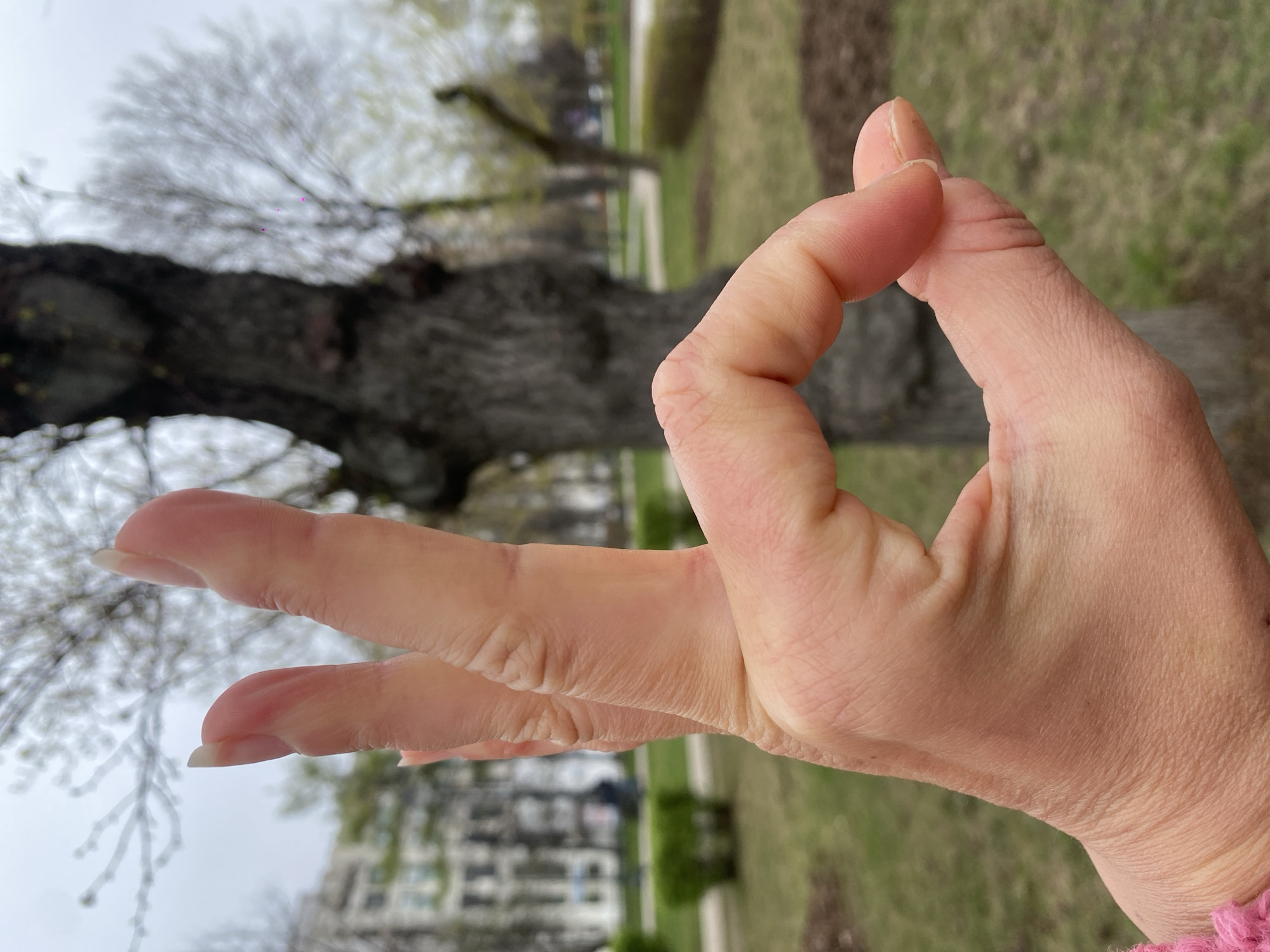 A close-up, correctly oriented photograph captures a human hand in the foreground, making a distinctive gesture against a softly blurred outdoor background. The hand is light-skinned, with the thumb and index finger forming a closed circle, while the remaining three fingers (middle, ring, and pinky) are extended upwards and slightly to the left. The fingernails are natural and extend slightly beyond the fingertips. A small portion of a pink, textured garment, likely a knitted sleeve, is visible at the wrist.
The background suggests an urban park or green space in Moscow, Russia. Dominating the mid-ground are large trees with bare or very sparse branches, indicative of late winter or early spring. The sky is overcast and bright, providing soft, even lighting across the scene. Below the trees, patches of green grass are visible, along with hints of a path or road. In the distant background, blurry architectural forms suggest urban buildings. No text is visible in the image.