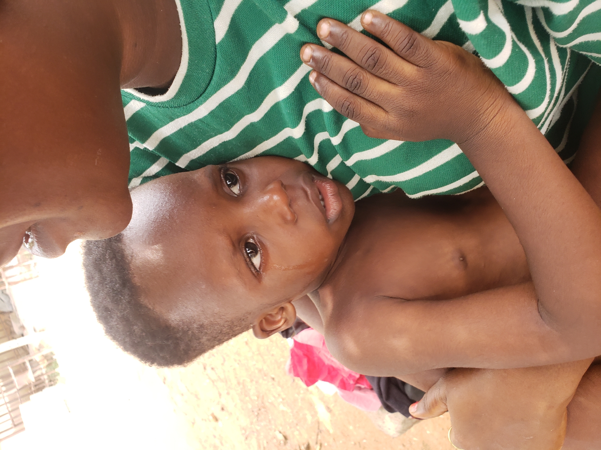 An adult is holding a young child outdoors in Adankolo, Nigeria, captured in a close-up, sideways perspective. The child, with dark skin and short, dark hair, is shirtless and looks directly at the viewer with wide, possibly teary eyes, and visible tear streaks on their face, indicating distress or recent crying. Their right hand rests on the adult's chest. The adult, also with dark skin, is partially visible on the left, showing their chin and mouth area, and is wearing a green and white striped shirt. One of the adult's hands, wearing a gold ring, is holding the child. The background consists of reddish-brown ground, suggesting an outdoor, unpaved setting under bright daylight conditions. Faint glimpses of red and black fabric are visible on the ground behind the child. No text is visible in the image.