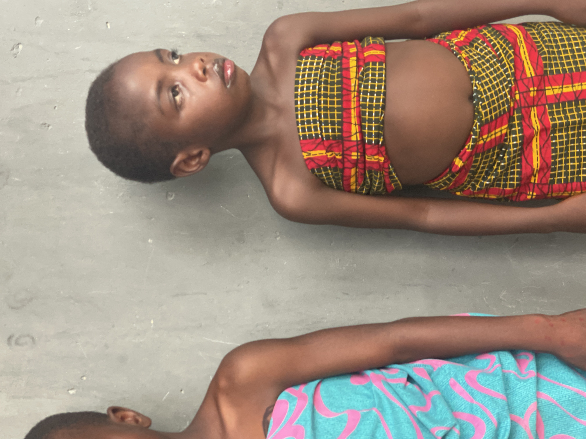 Two children are seen lying side-by-side on a gray, concrete-like surface, possibly an indoor floor or an outdoor paved area, in Badagry, Nigeria. The image is taken from an overhead perspective.
The child in the upper part of the frame is lying on their back, looking slightly upward and to the right. They have short, dark hair and dark skin. A vibrant, intricately patterned fabric, primarily red, yellow, and black with a grid-like design and stripes, is wrapped around their torso, covering their chest and midsection. Their arms are relaxed at their sides. The child appears to be thin, with visible ribs. Their expression is neutral, perhaps pensive.
Partially visible in the lower part of the frame is a second child, also lying down. Only their head, an arm, and part of their torso are visible. They are covered with a different patterned fabric, which is teal with prominent pink, swirled designs. This child's face is mostly out of frame, showing only the back of their head and an ear.
The lighting is even and diffuse, with no strong shadows, making the time of day indeterminate. There is no visible text in the image. The setting appears simple and unadorned.