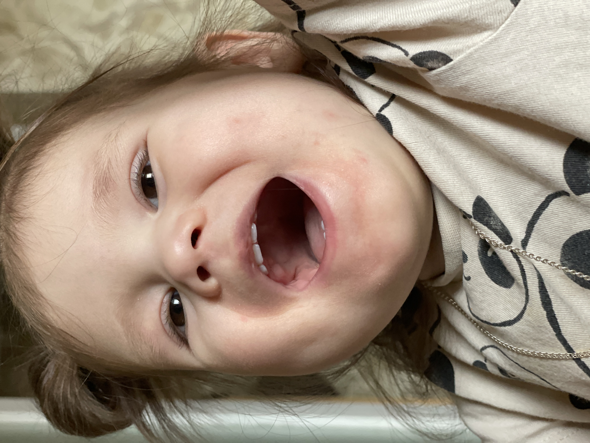 A young child with brown eyes and light brown hair is pictured with their head tilted to the side, face towards the camera, and mouth open. The child appears to have a few visible teeth. The child is wearing a light-colored shirt with a black pattern and a silver chain necklace. There are some minor red marks on the child's cheek. The background appears to be a light cream color. No information about Izhevsk, Russia can be extracted from the image.