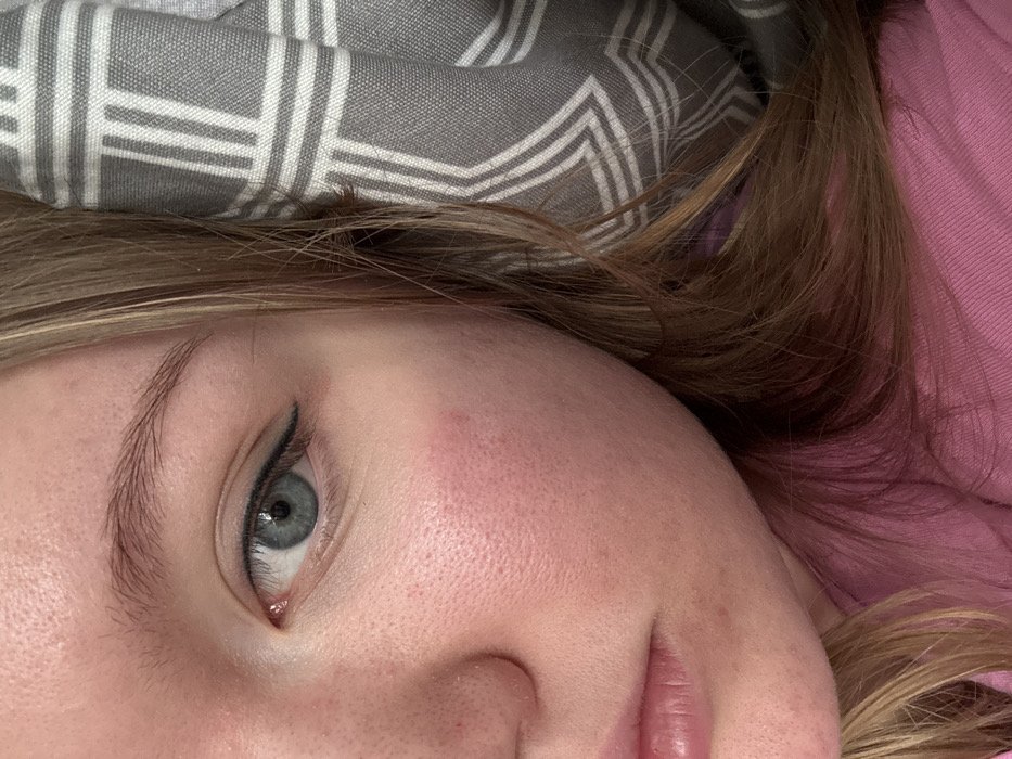 The image displays a close-up, angled view of the left side of an individual's face, located in Nizhnekamsk, Russia. The subject has fair skin with visible pores and diffuse erythema across the left cheek, extending below the eye. The left eye, with a blue-grey iris and visible pupil, is open, featuring a black winged eyeliner applied to the upper eyelid. A light brown eyebrow is present above the eye. The bridge and left ala of the nose are partially visible on the left side of the frame. The upper lip and a portion of the lower lip are also visible. Light brown hair, appearing somewhat tousled, cascades along the right side of the face. Beneath the hair, a segment of a pink garment is discernible. To the right of the hair, a grey fabric with a repeating white geometric pattern (resembling interlocking 'H' shapes or squares) is visible, suggesting an indoor environment. No overt action or interaction is depicted.