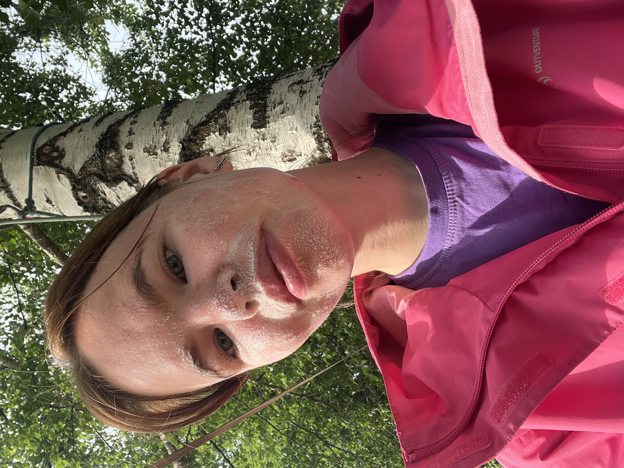 A low-angle, close-up selfie features a person wearing a bright pink jacket over a purple t-shirt. The person's face is tilted upwards, with a portion of a birch tree trunk visible in the background, along with lush green foliage and a bright sky. The person's skin appears flushed and has white patches, possibly from sunscreen or a rash. Their eyes are open and looking towards the camera, and their lips are slightly parted. A small, silver earring is visible in their right ear. The lighting suggests it is daytime, likely sunny, given the shadows and highlights. The text "OUTVENTURE" is visible in white lettering on the inside of the pink jacket. The scene appears to be outdoors, possibly in a wooded or park-like area, consistent with a location in Sergino, Russia. The overall impression is of a casual, outdoor snapshot, perhaps taken during a recreational activity.
