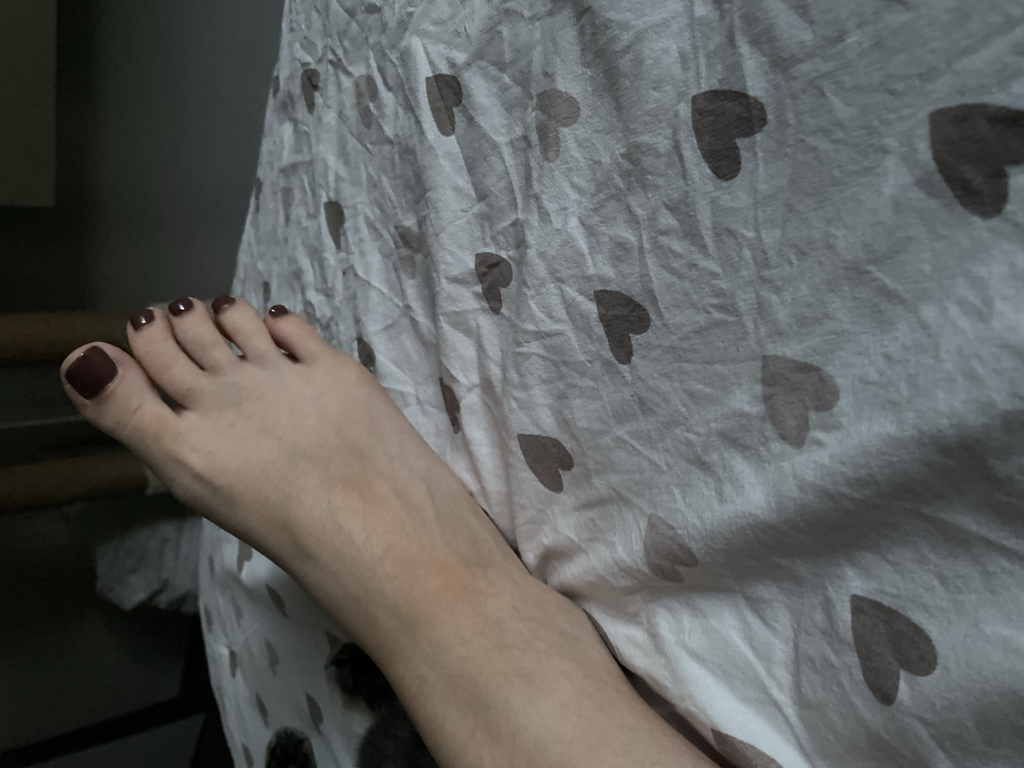 A person's foot, with dark red nail polish on the toenails, rests on a white bedsheet patterned with grey hearts. The foot is positioned from the ankle to the toes, with the toes slightly curled. The skin of the foot and lower leg is visible, showing veins and some discoloration. The background is dark and out of focus, with hints of a wooden object and some crumpled white material. The scene appears to be indoors, likely in a bedroom. This image was taken in Monastyrskoe, Russia.
