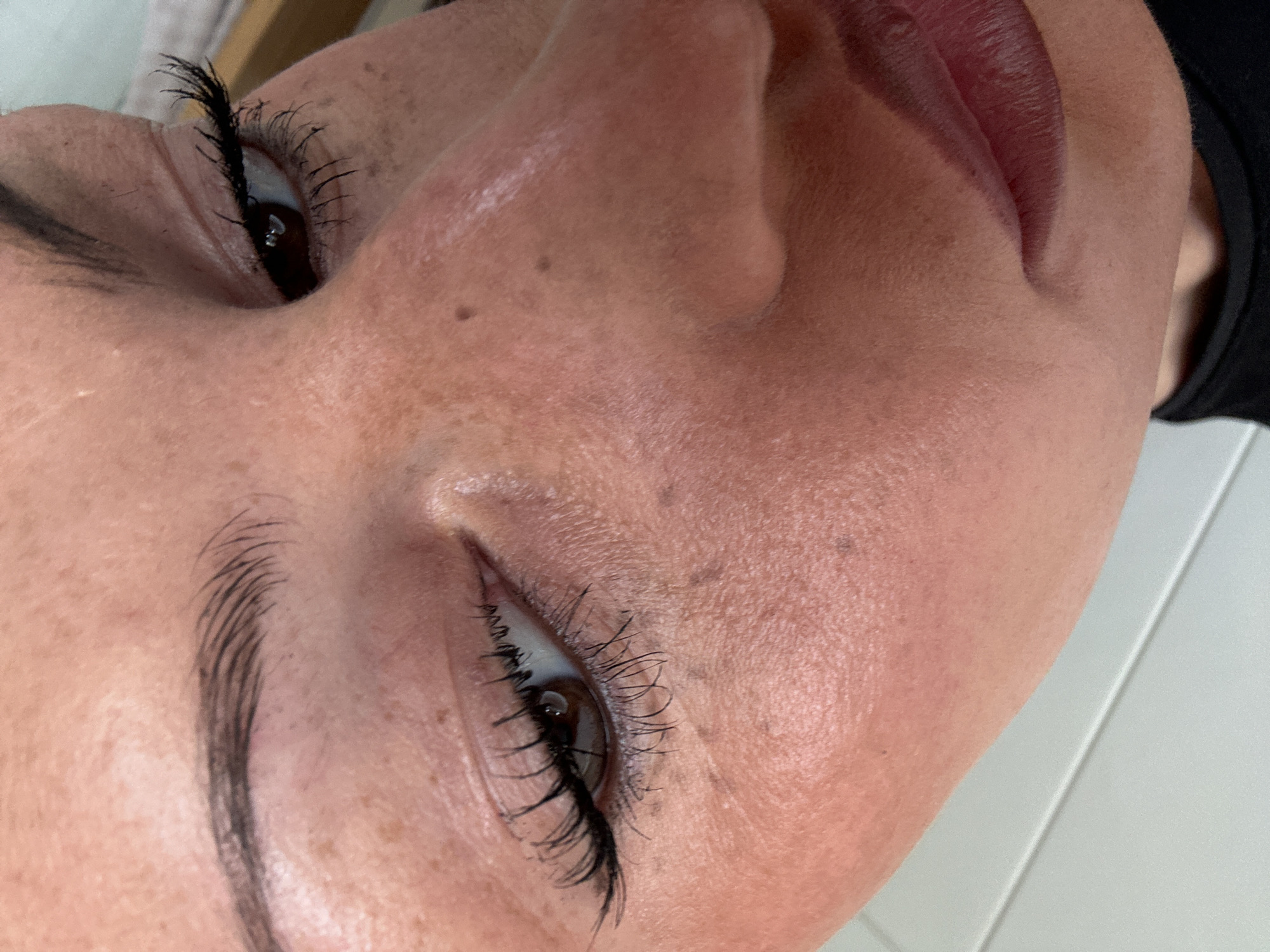 A close-up, angled view of a person's face. The individual has brown eyes and dark eyelashes, likely enhanced with mascara. Their skin tone is light with freckles and two prominent moles near the nose. Their lips are visible, with a dark lipstick or lip stain. Part of their eyebrow is visible. To the side, a portion of a black garment is visible, and a glimpse of a white surface is present in the lower right corner. The photo does not provide information about Wealden, United Kingdom.