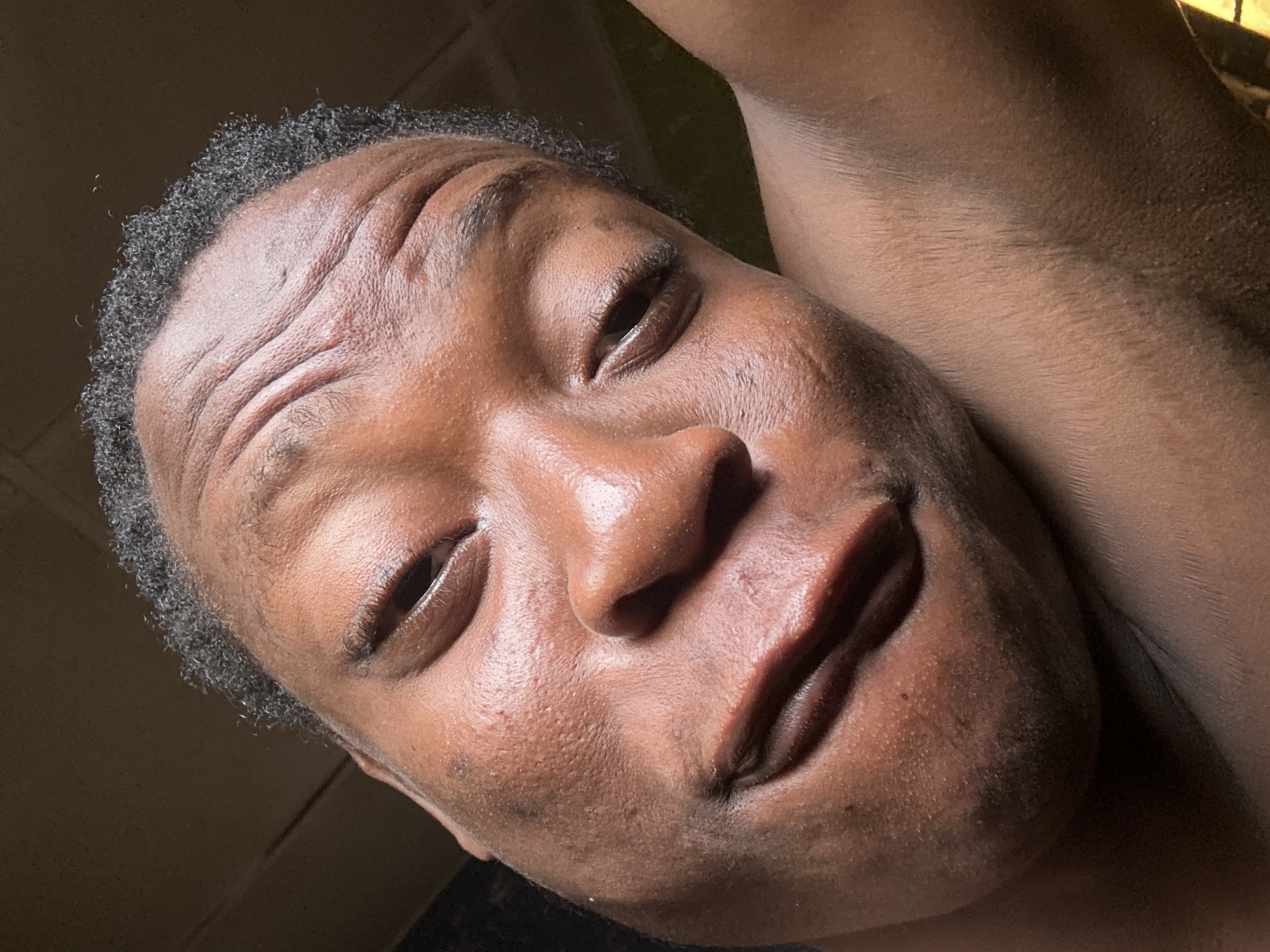 A close-up, diagonally oriented portrait features a person with dark skin and short, tightly curled dark hair. The individual, likely an adult male, is captured from a low angle, looking slightly upwards and to the side. Their expression is subtle, possibly a slight smirk or a thoughtful look, with eyes slightly narrowed. Distinct horizontal wrinkles are prominent across the forehead, accentuated by the lighting.
Strong, directional light from the upper left illuminates the face, creating highlights on the forehead, bridge of the nose, and lips, while casting shadows that define facial contours. The skin texture reveals visible pores and some minor blemishes. A portion of a bare arm or shoulder is visible in the upper right quadrant of the frame. The background is dark and indistinct, suggesting an indoor setting with limited ambient light. No specific location cues or visible text are present. The overall impression is intimate and casual.