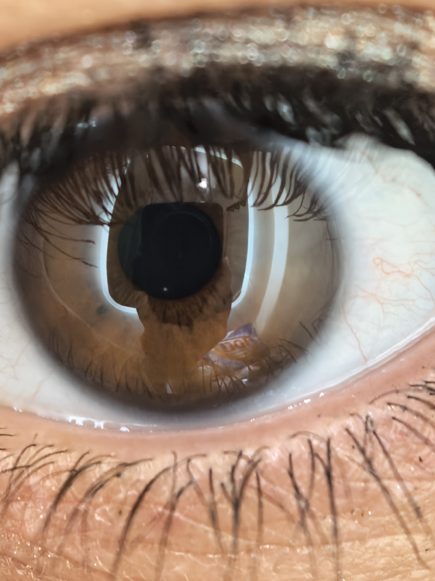 This is an extreme close-up, eye-level, interior shot of a human eye. The image is a macro photograph focusing on the iris, pupil, and surrounding sclera. The iris is a warm brown color with lighter brown striations. The pupil is a dark, circular void at the center of the iris. The sclera, or the white part of the eye, is visible and shows a network of fine red blood vessels. Reflections are visible on the surface of the cornea, including a reflection of the photographer holding a camera and what appears to be a partially visible object with orange and purple colors. Eyelashes frame the upper and lower parts of the eye, appearing dark and textured. The skin around the eye is also visible, showing pores and a slightly pink hue. The lighting creates highlights on the wet surface of the eye. There are no discernible details about the location in a city.