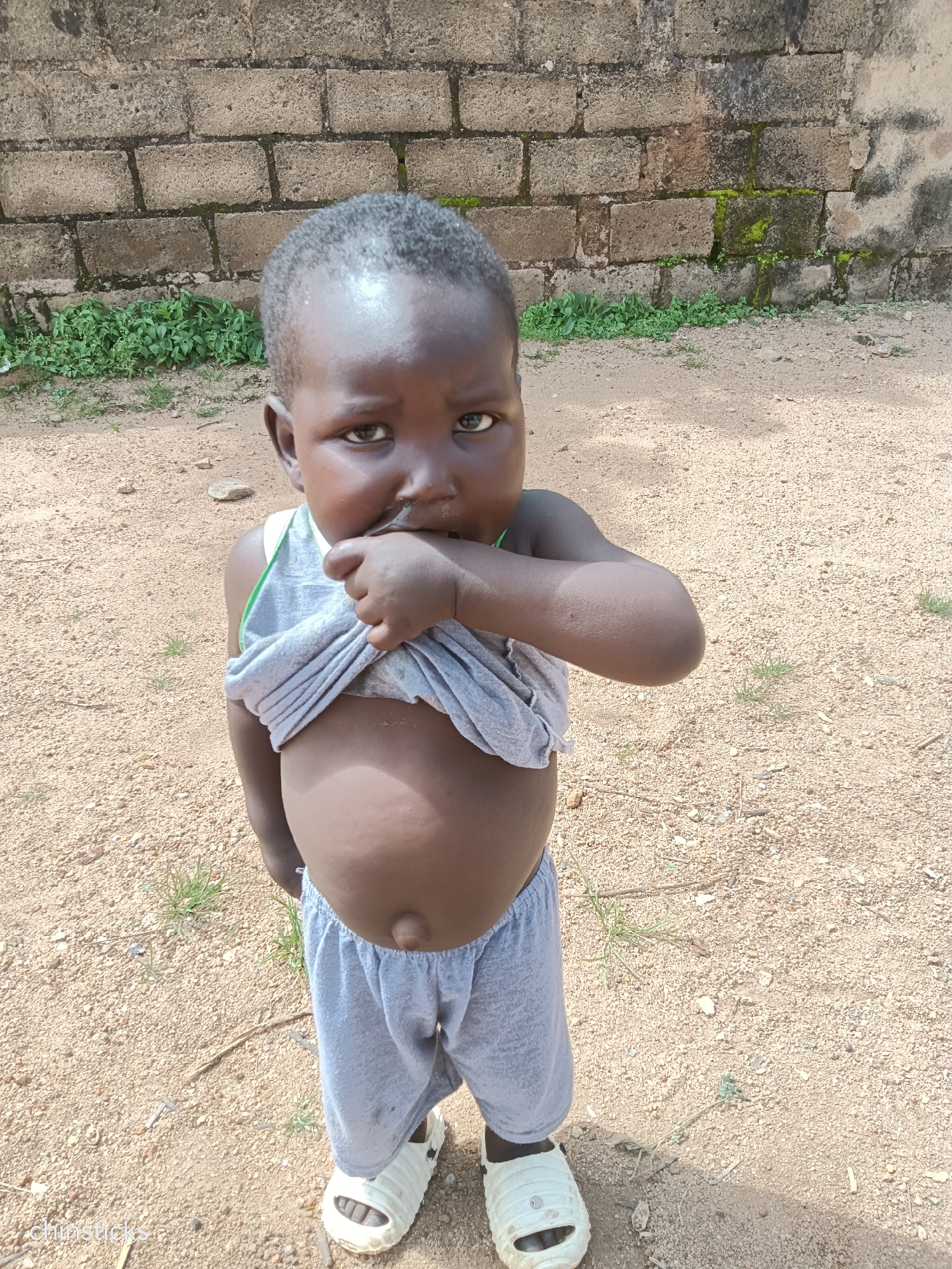 This is a medium shot of a young child standing in a dusty, outdoor setting. The child, who appears to be of African descent, is wearing grey shorts and a grey tank top that is pulled up to reveal their abdomen. Their right hand is near their mouth, as if they are sucking their thumb or chewing on their fingers. The child has dark skin, short dark hair, and is looking directly at the camera with a serious expression.
Behind the child is a rough-hewn brick wall, some of which is covered in moss. Green plants are growing at the base of the wall. The ground is covered in light brown dirt and small stones. The lighting suggests it is daytime, with the sun casting a shadow on the ground to the right of the child. The overall setting appears to be a simple, perhaps rural or semi-urban environment in Jos, Nigeria.
A small, watermark text "chinsticks." is visible in the bottom left corner of the image.