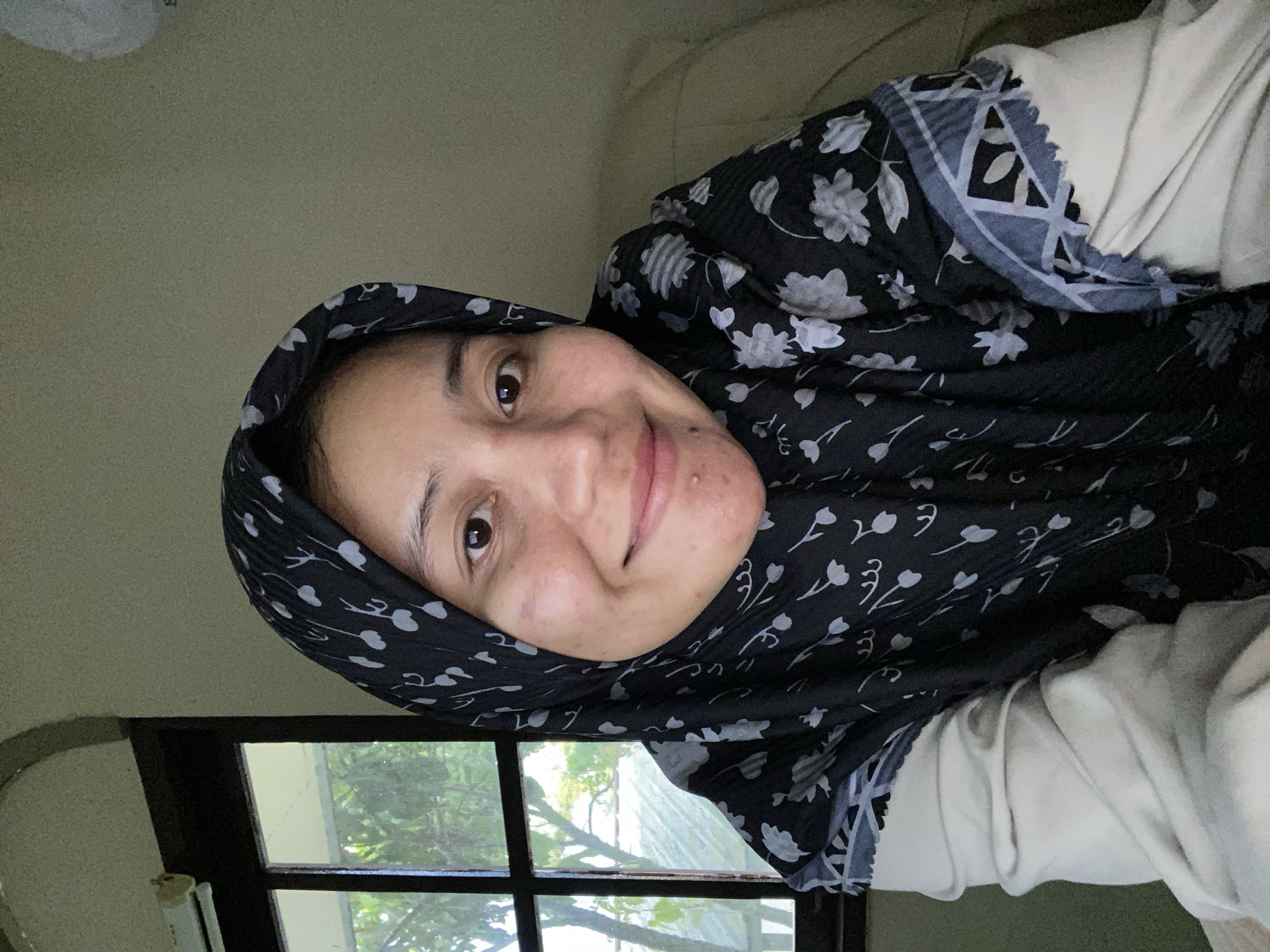 This is a portrait of a young woman wearing a black hijab with a white floral pattern. Her head is tilted, and she is smiling softly at the camera. She has brown eyes and appears to have some blemishes on her face. She is wearing a light-colored garment underneath her hijab. The background is a room with a wall and a window. Through the window, lush green trees and foliage are visible, suggesting it is daytime and likely a pleasant weather day. A dark-colored window frame is also visible. The overall impression is a casual, personal photograph, possibly a selfie, taken indoors in a residential setting in Banjarbaru, Indonesia. There is no visible text in the image.
