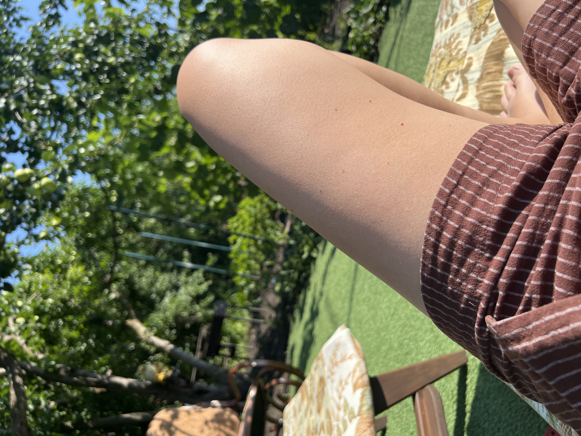 The image shows a close-up of a person's legs and lower torso, with a pattern of red and white stripes on their shorts. The person is lying down, with their legs stretched out. Their skin is tanned and there are a few small red marks on their thigh. In the background, there is a garden with lush green trees and foliage, and a clear blue sky. There is also a chair with a patterned cushion visible on the left side of the image. The lighting suggests it is a sunny day. The scene appears to be an outdoor setting, possibly a backyard or park. There is no identifiable information to confirm the location as Lopatino, Russia.