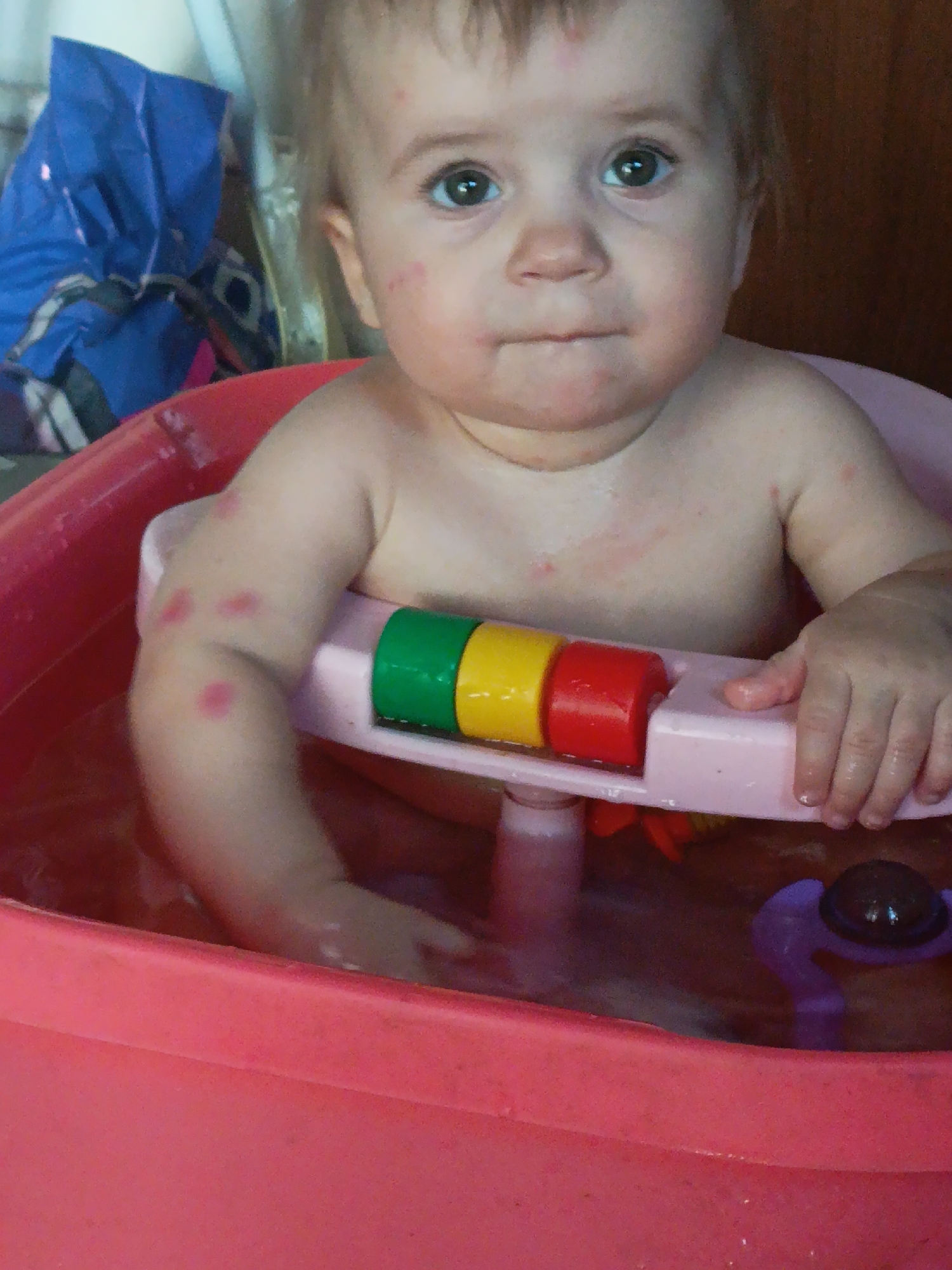 A close-up, waist-up shot shows a baby sitting in a pink plastic bathtub filled with water. The baby has light brown hair and is looking towards the camera with large, dark eyes. There are red marks, possibly a rash or mosquito bites, visible on the baby's face, chest, and left arm. The baby is holding onto a pink plastic bath seat with a toy attached that has green, yellow, and red cylindrical pieces. A purple toy with a black ball on top is partially submerged in the water to the right of the bath seat. In the background, a blue plastic bag is visible. The image is taken from a slightly high angle.